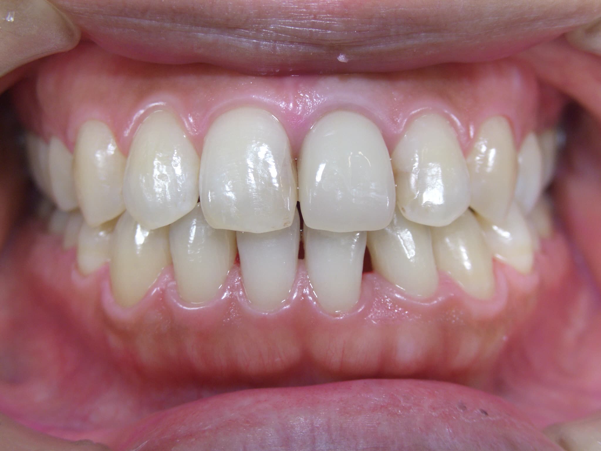 0000003242_%e4%bb%8a%e9%87%8e-%e7%94%b1%e5%88%a9_camera_20150205175803