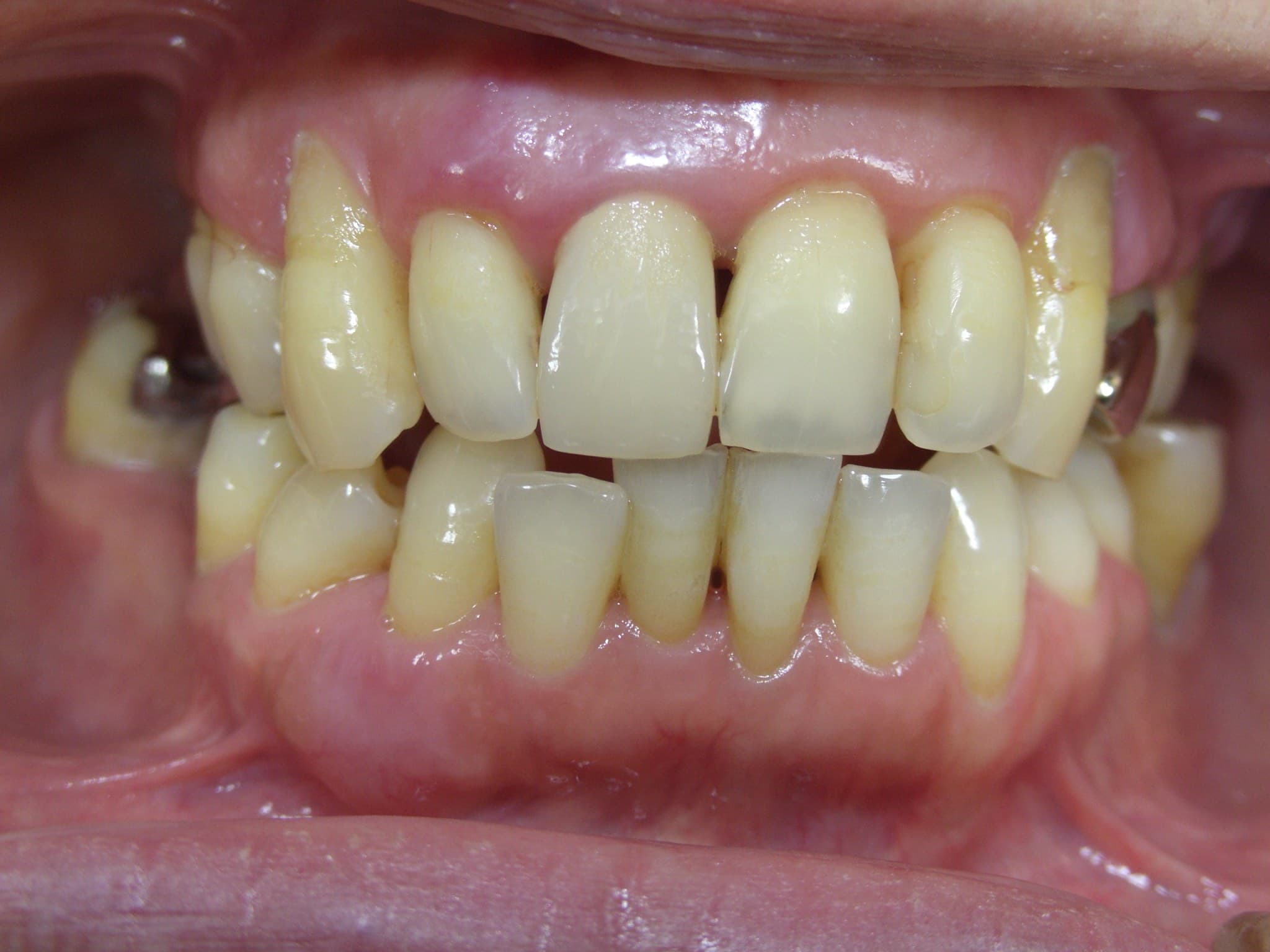 %e4%b8%ad%e8%a5%bf-%e6%b4%8b%e5%ad%90_c01_20150609_154834009