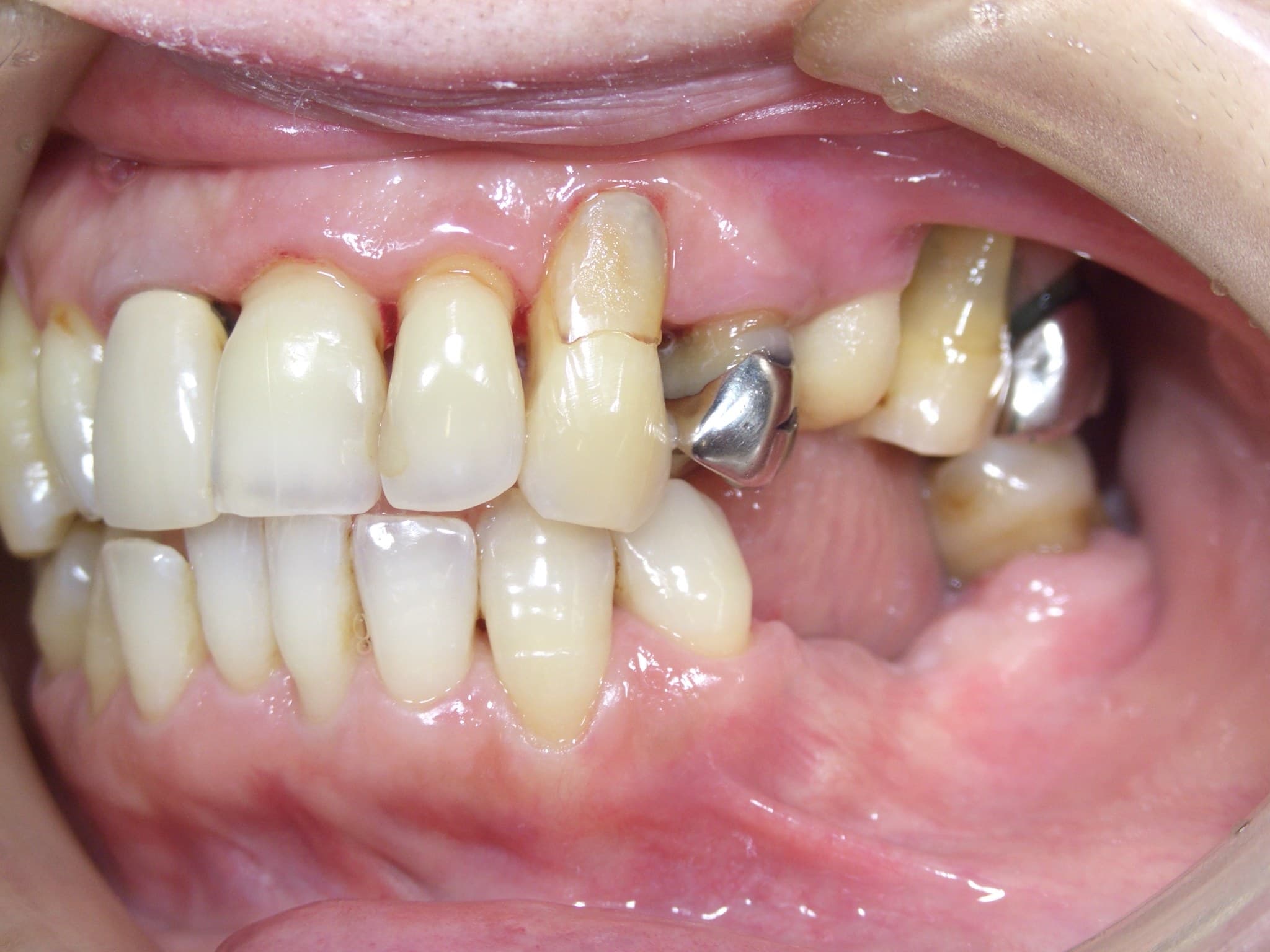 %e4%b8%ad%e8%a5%bf-%e6%b4%8b%e5%ad%90_c06_20160428_160348000