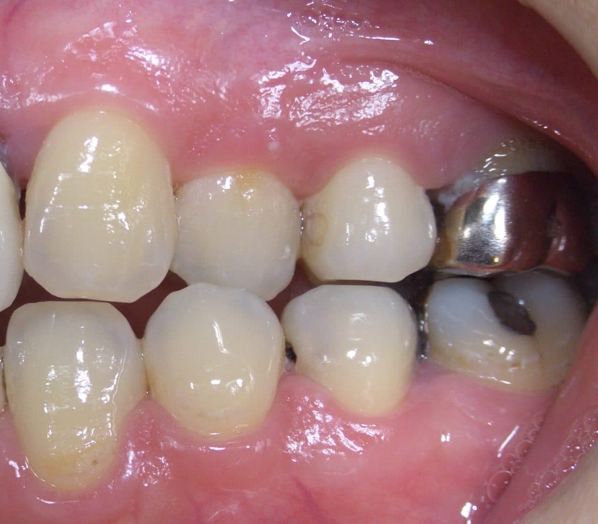 %e5%8d%97%e9%9b%b2-%e3%81%bf%e3%82%86%e3%81%8d_c11_20150817_143448005