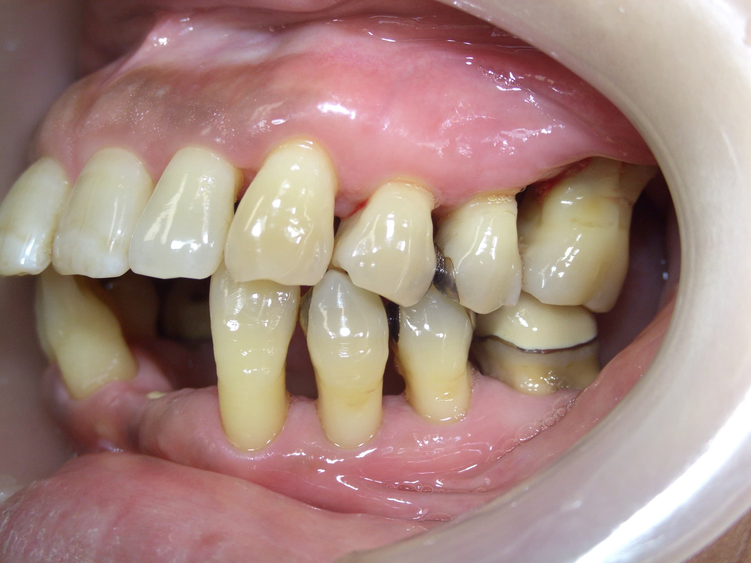 %e5%9c%9f%e7%94%b0-%e3%81%a4%e3%81%9f%e3%81%88_c06_20141229_113412011