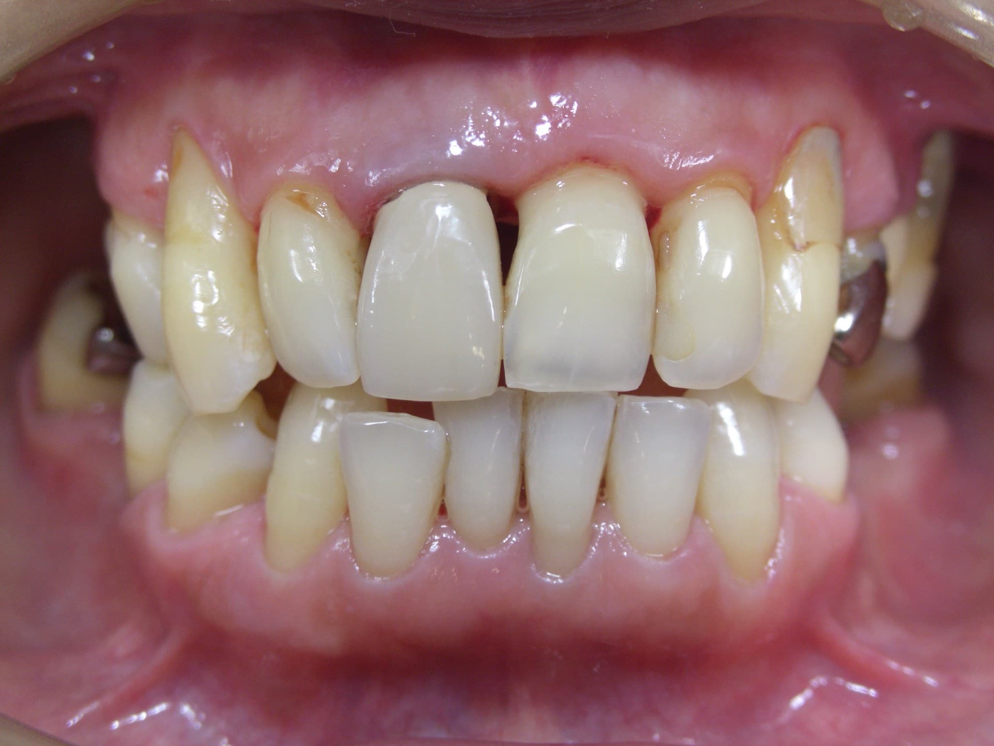 %e4%b8%ad%e8%a5%bf-%e6%b4%8b%e5%ad%90_c01_20160428_160324000