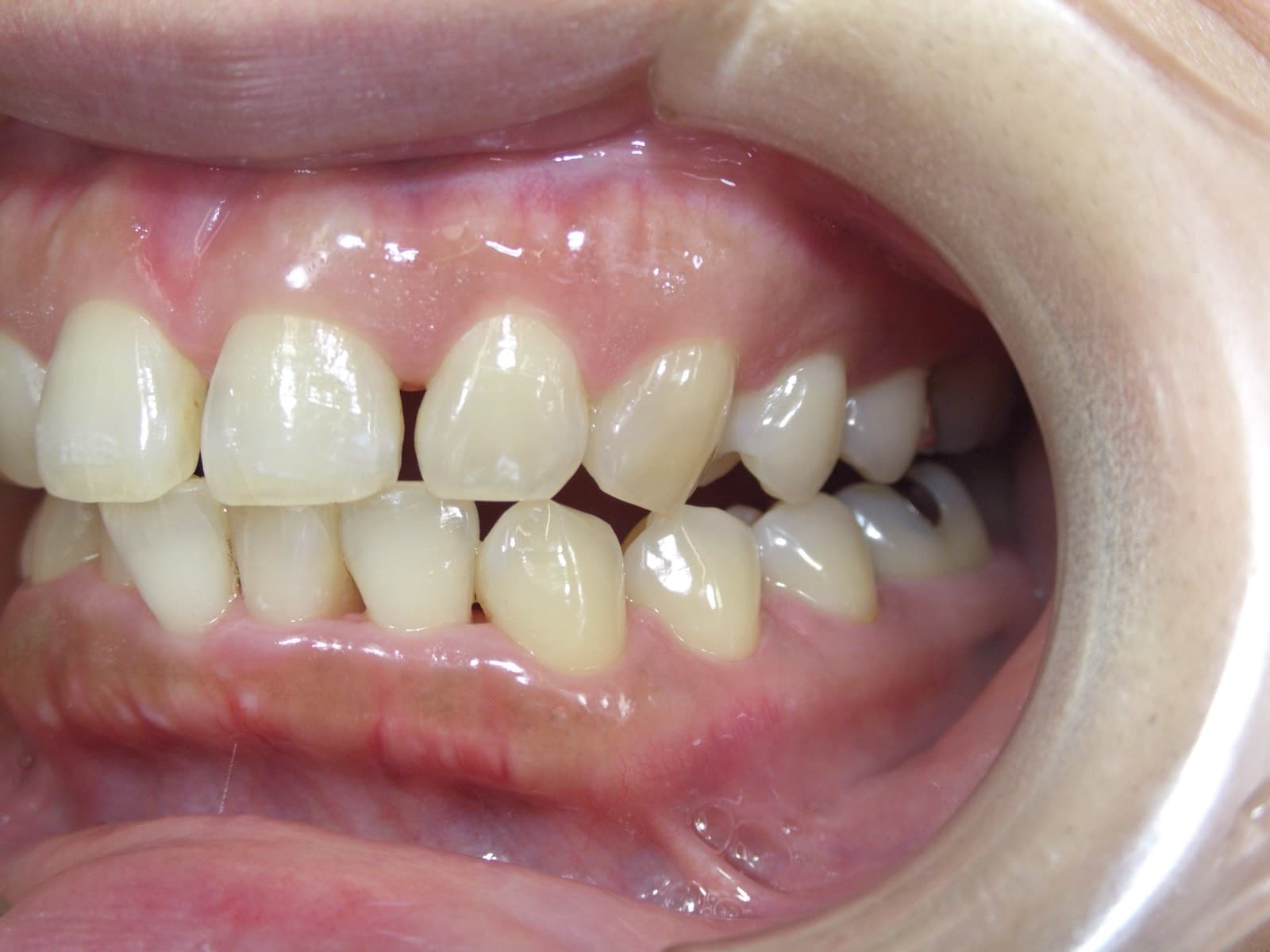 %e8%8f%85%e5%8e%9f-%e9%ba%bb%e9%87%8c%e5%ad%90_c06_20140601_204310010