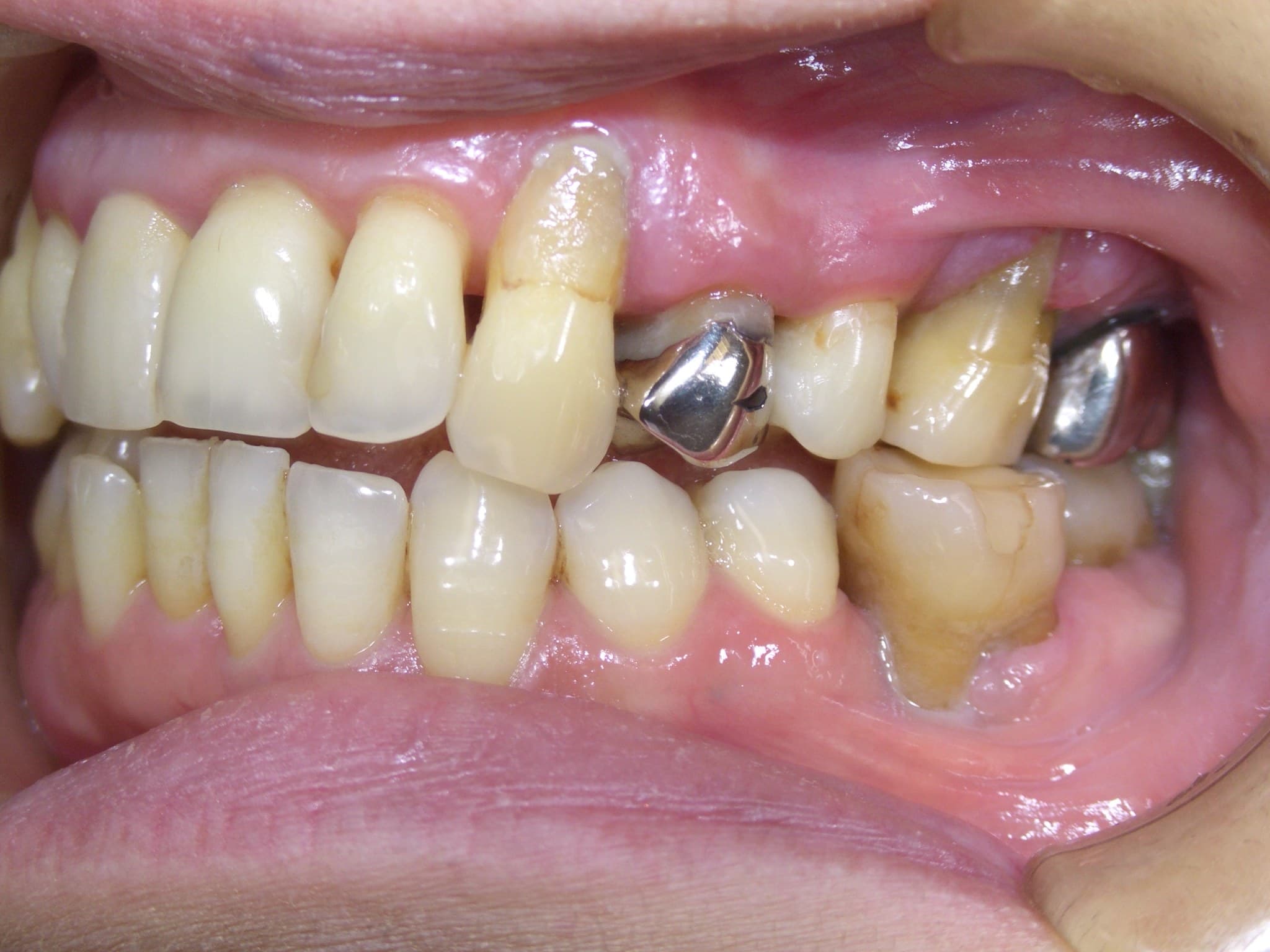 %e4%b8%ad%e8%a5%bf-%e6%b4%8b%e5%ad%90_c06_20150609_154856005