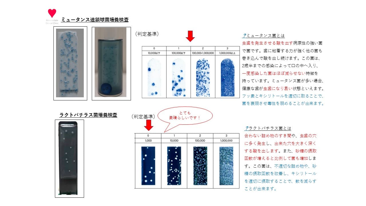 %e3%82%b9%e3%83%a9%e3%82%a4%e3%83%891