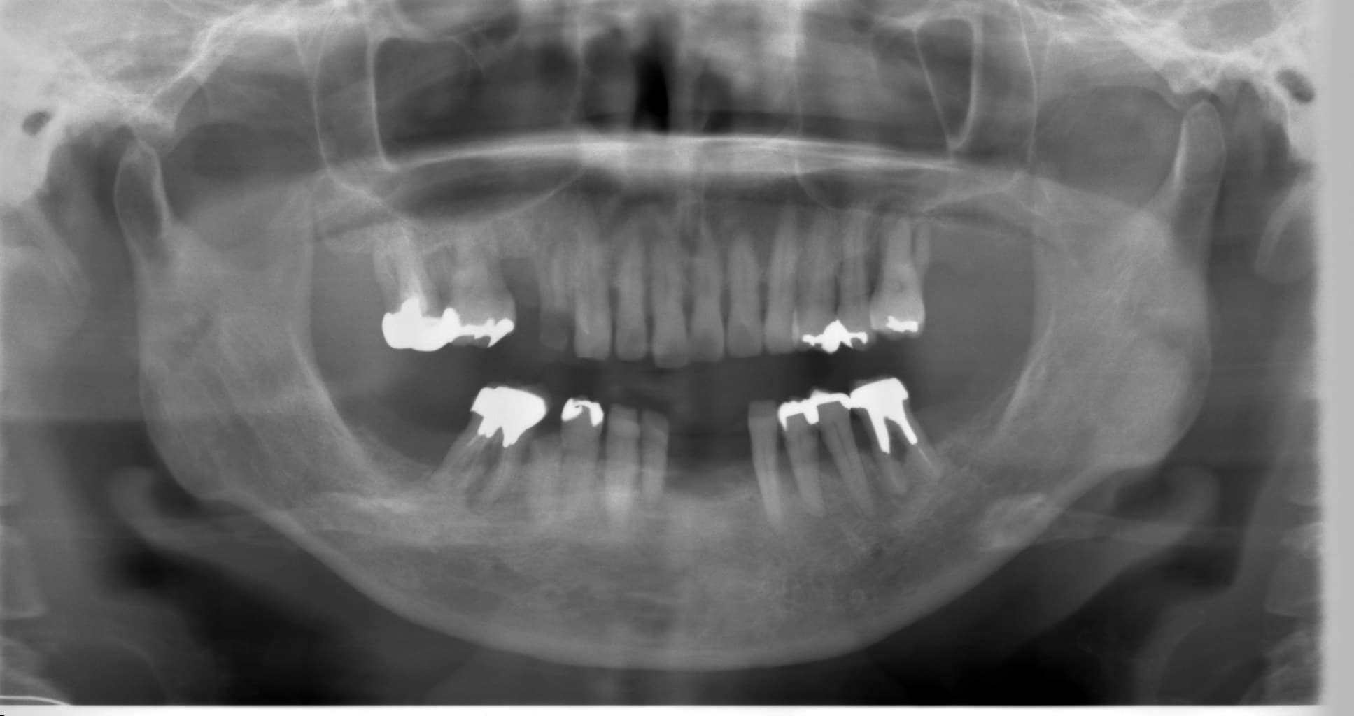 %e5%9c%9f%e7%94%b0-%e3%81%a4%e3%81%9f%e3%81%88_c06_20140718_141014004