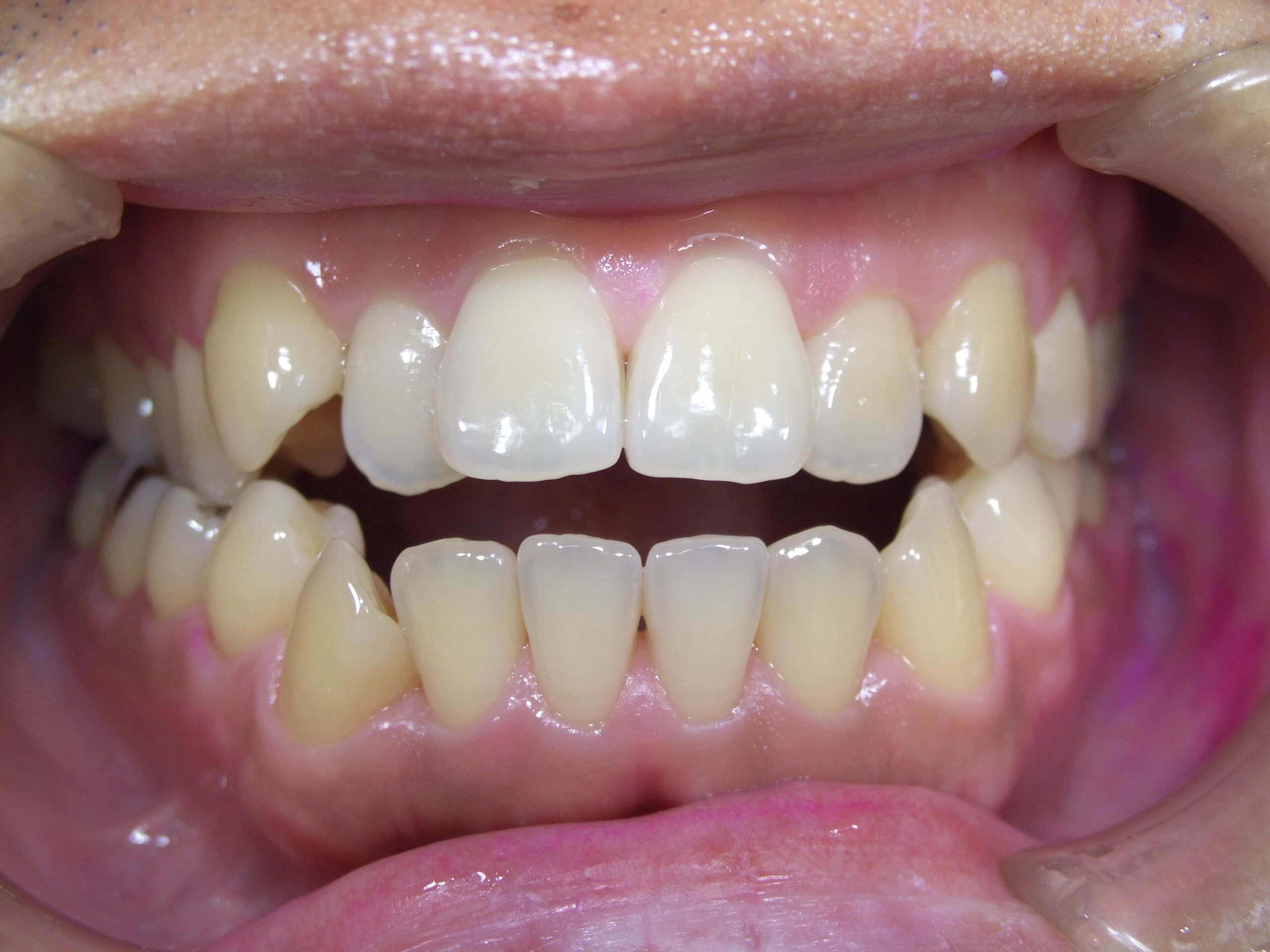 0000003274_%e8%8f%85%e9%87%8e-%e5%85%89_camera_20141219180147