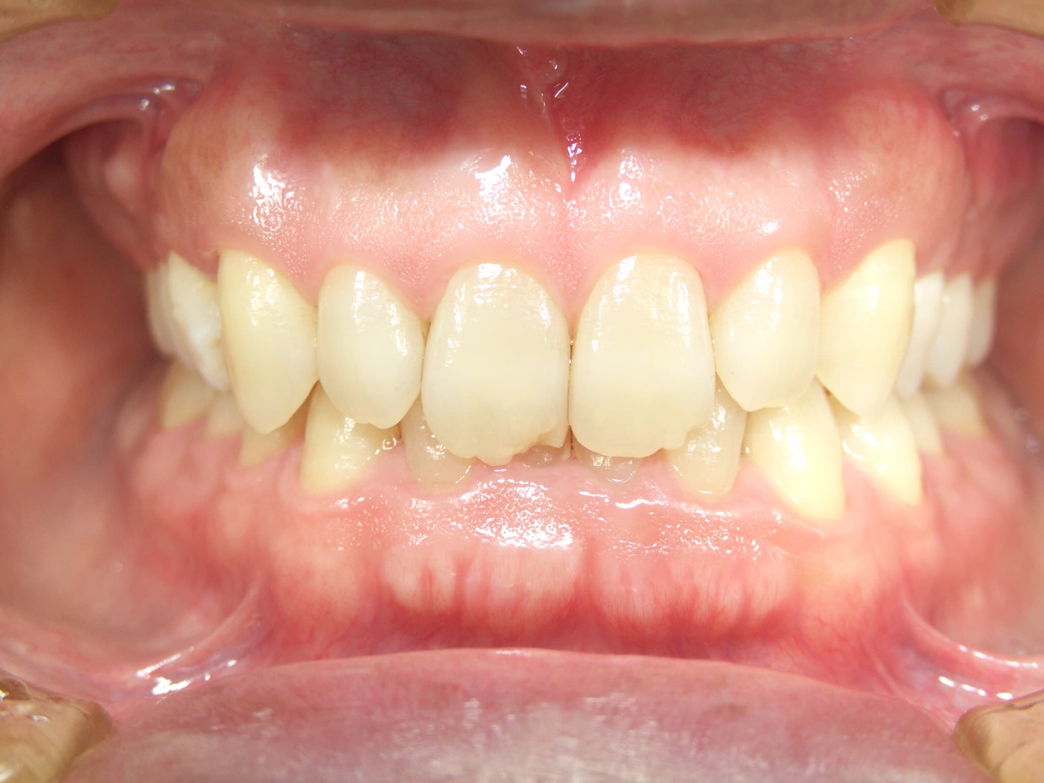 0000001058_%e9%ab%98%e6%a9%8b-%e6%9c%9b_camera_20150910113512