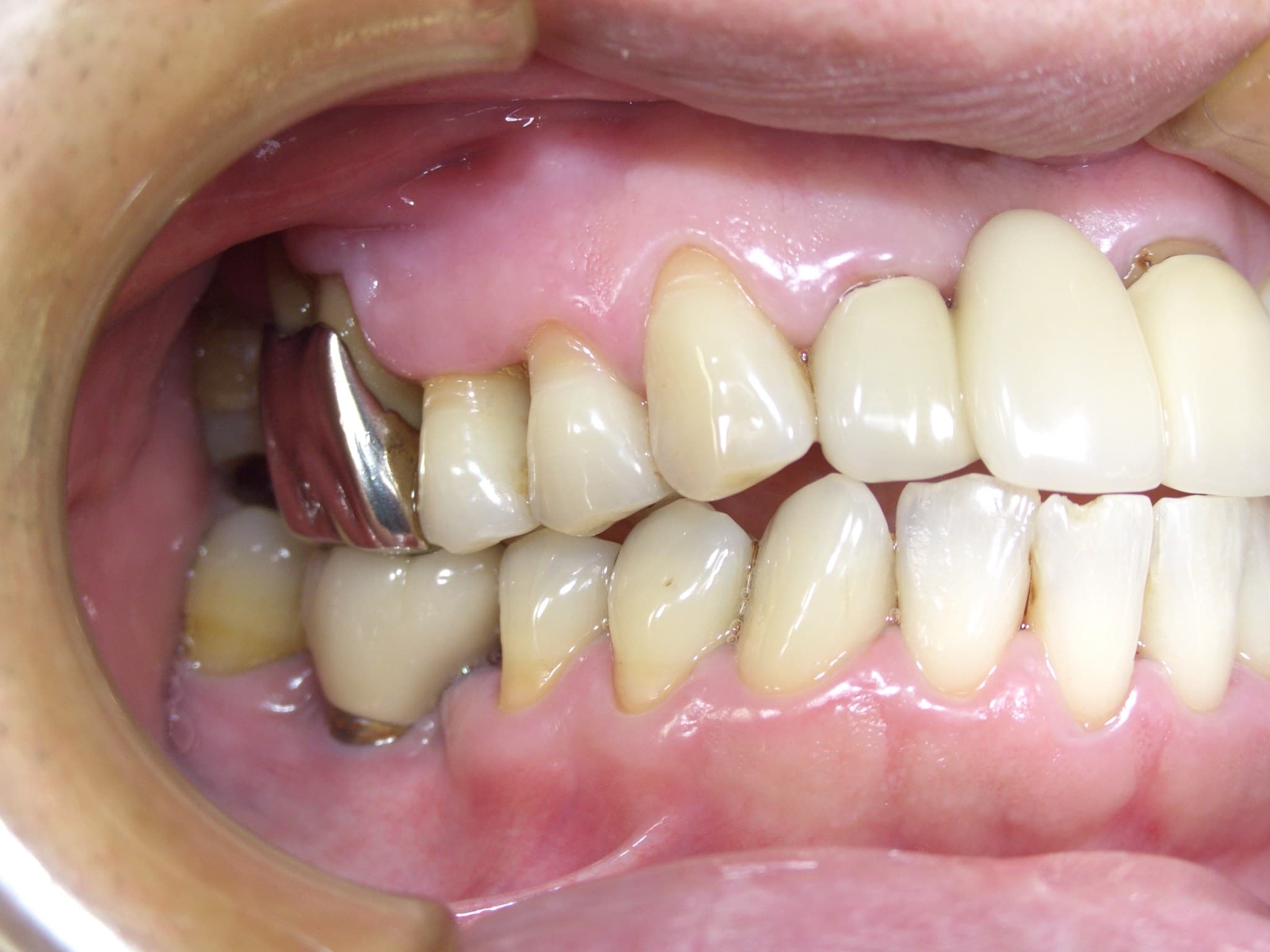 %e6%a1%82%e6%9c%a8-%e8%81%96%e5%bd%a6_c04_20160418_161310000