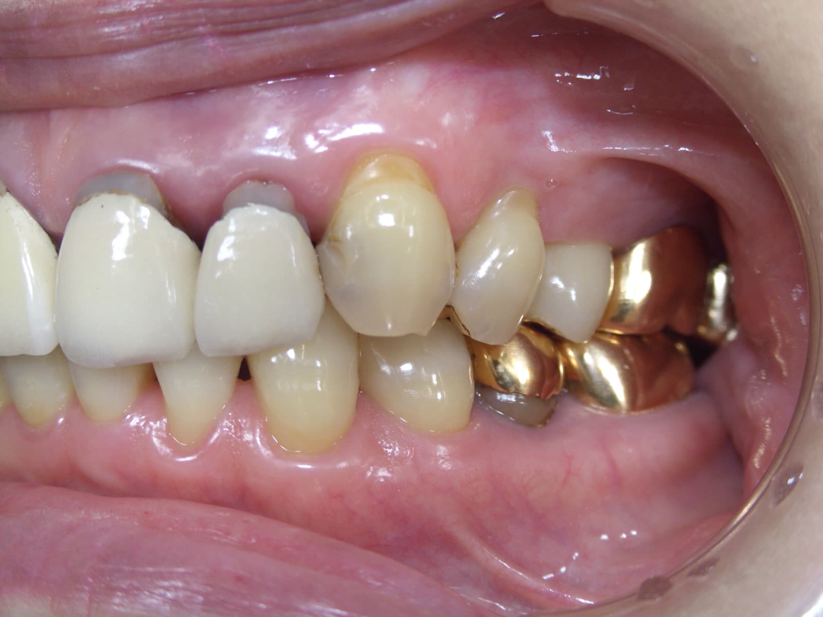 0000003295_%e4%bb%8a%e9%87%8e-%e7%9f%a5%e6%b4%a5%e5%ad%90_camera_20140919002857