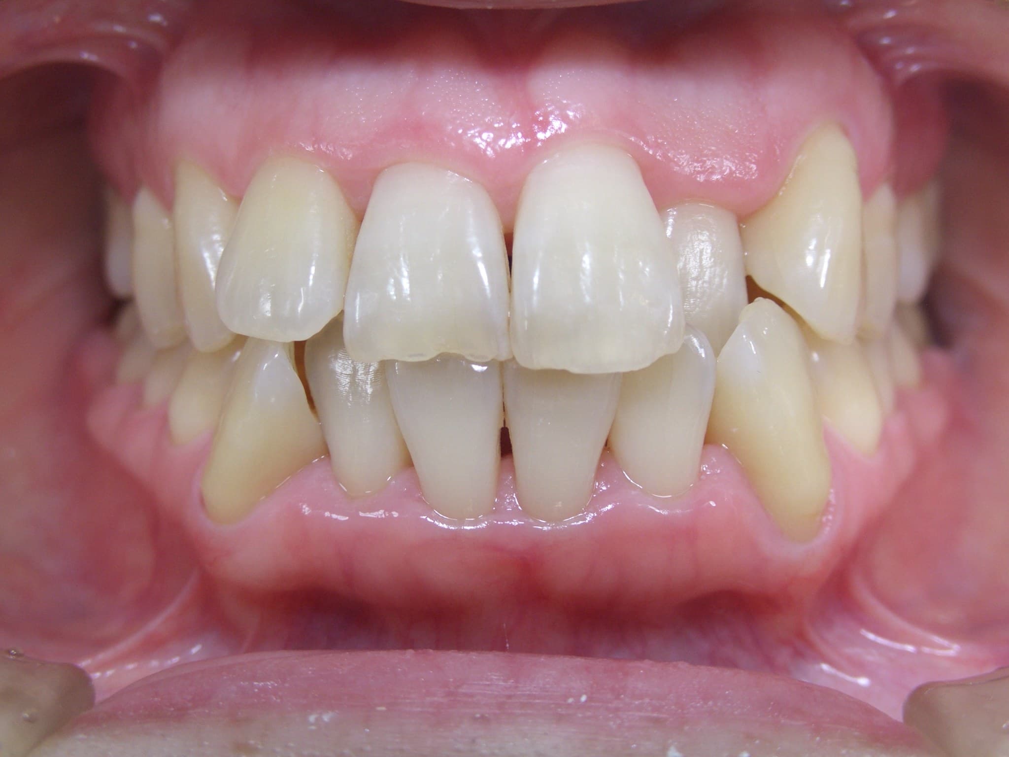 %e9%ab%99%e6%a9%8b-%e7%94%b1%e4%bd%b3_c01_20141110_224006013