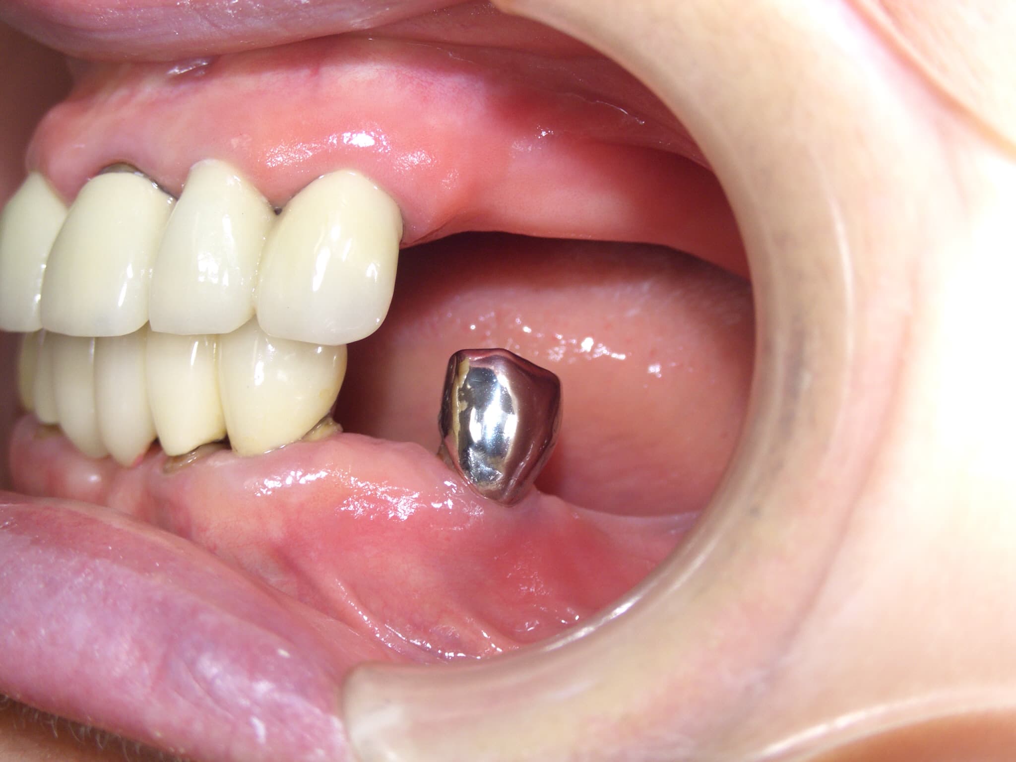 0000003272_%e5%8f%a4%e5%b1%8b-%e5%af%8c%e4%b9%85%e7%be%8e_camera_20141105225810