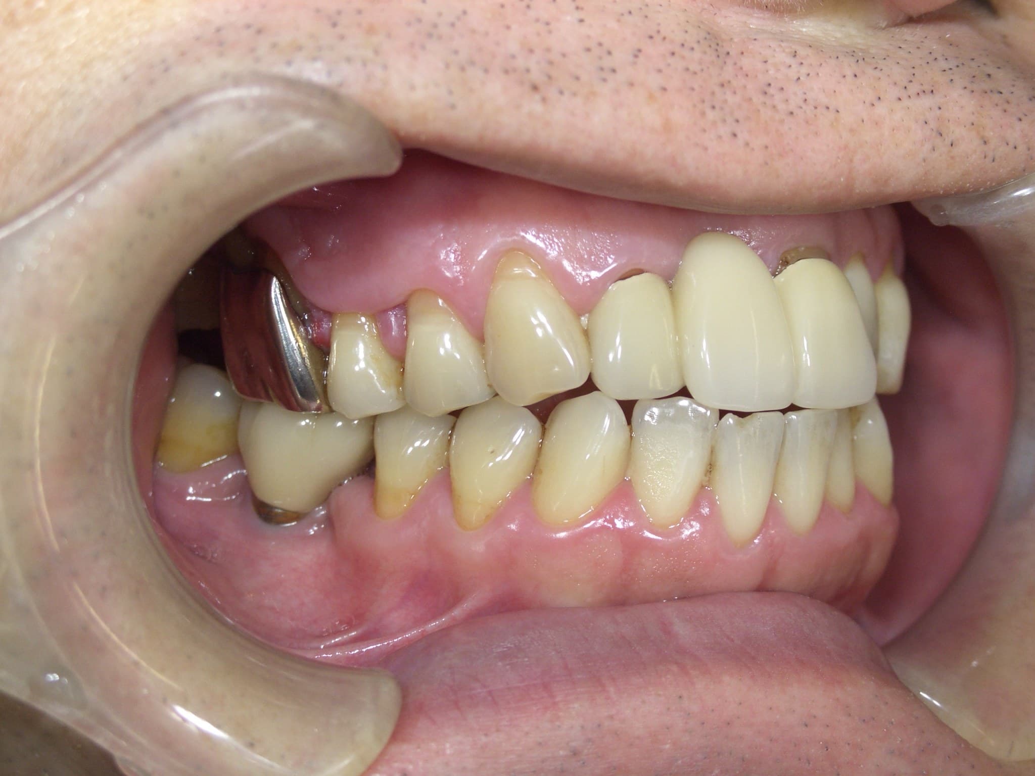 %e6%a1%82%e6%9c%a8-%e8%81%96%e5%bd%a6_c04_20160215_114928002