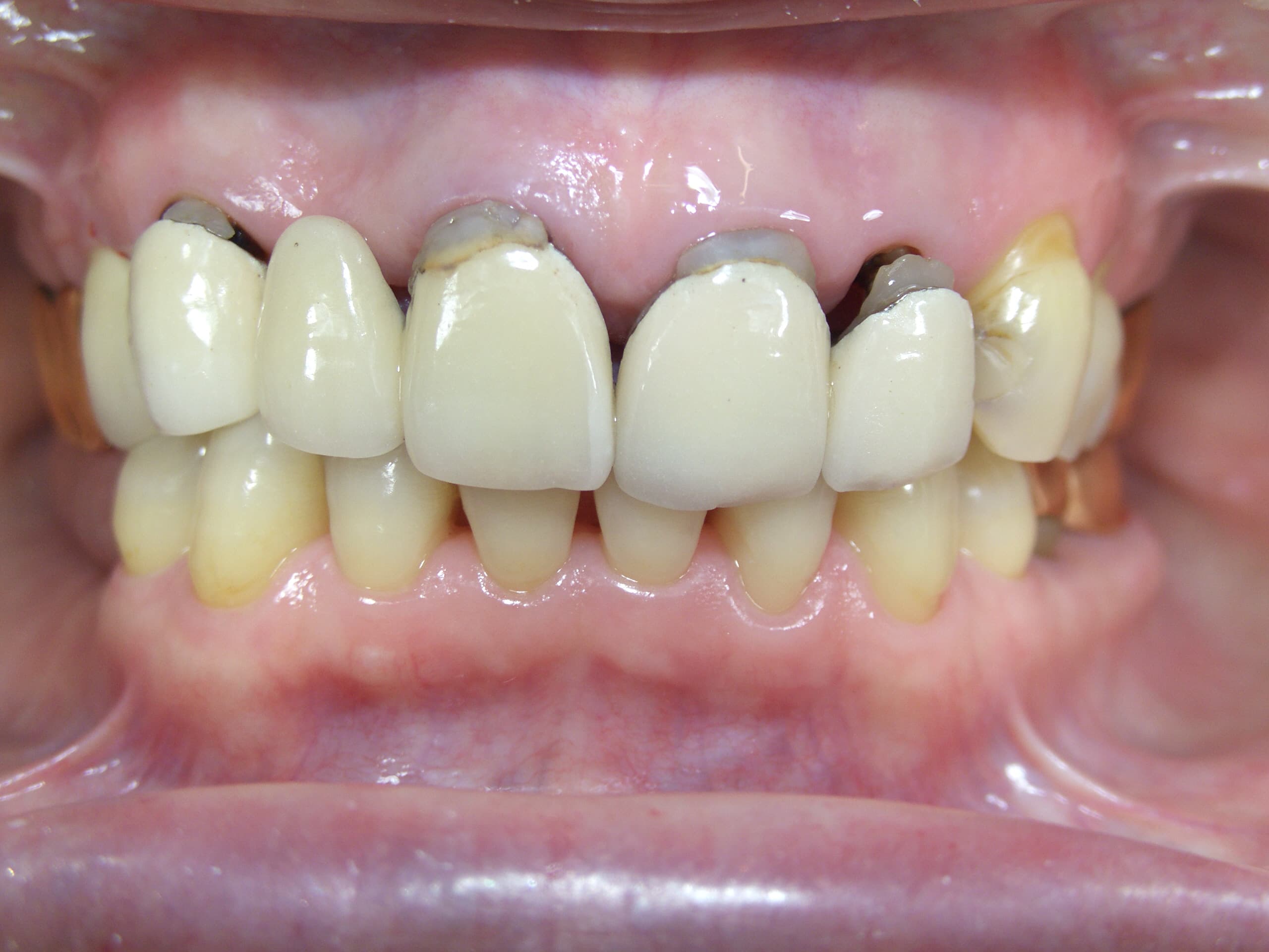 0000003295_%e4%bb%8a%e9%87%8e-%e7%9f%a5%e6%b4%a5%e5%ad%90_camera_20150105104242