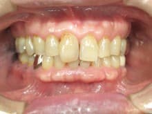 %e6%ad%a3%e9%9d%a2%ef%bc%92