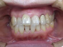 %e6%ad%a3%e9%9d%a2%ef%bc%92