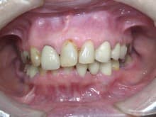 %e6%ad%a3%e9%9d%a2%ef%bc%92