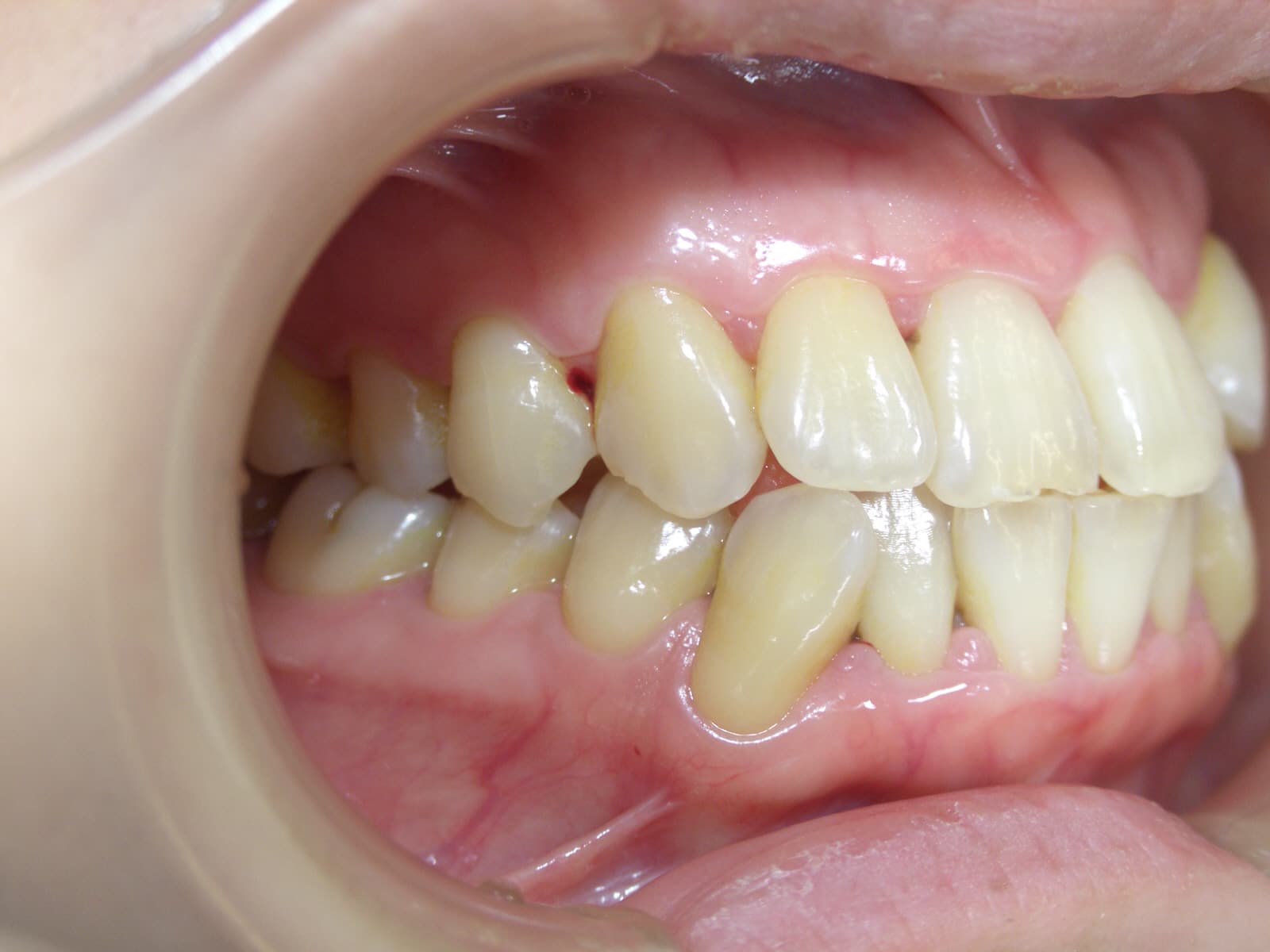 0000003254_%e9%ab%99%e6%a9%8b-%e7%94%b1%e4%bd%b3_camera_20140722112206