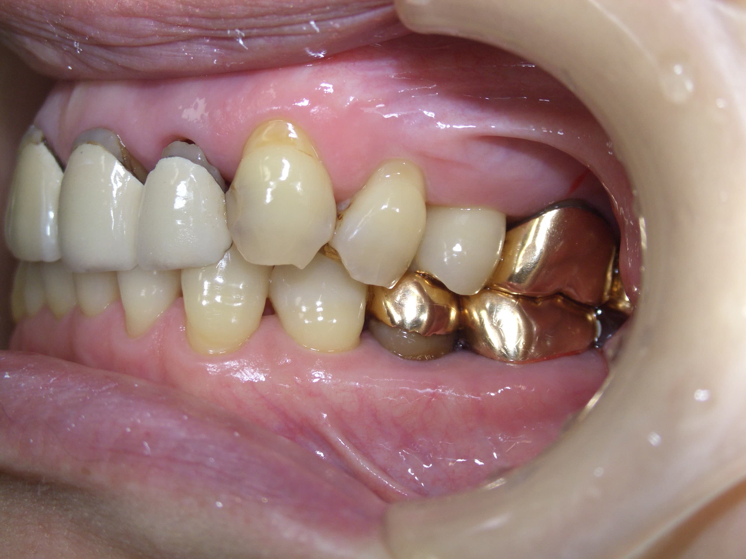 0000003295_%e4%bb%8a%e9%87%8e-%e7%9f%a5%e6%b4%a5%e5%ad%90_camera_20150105104321