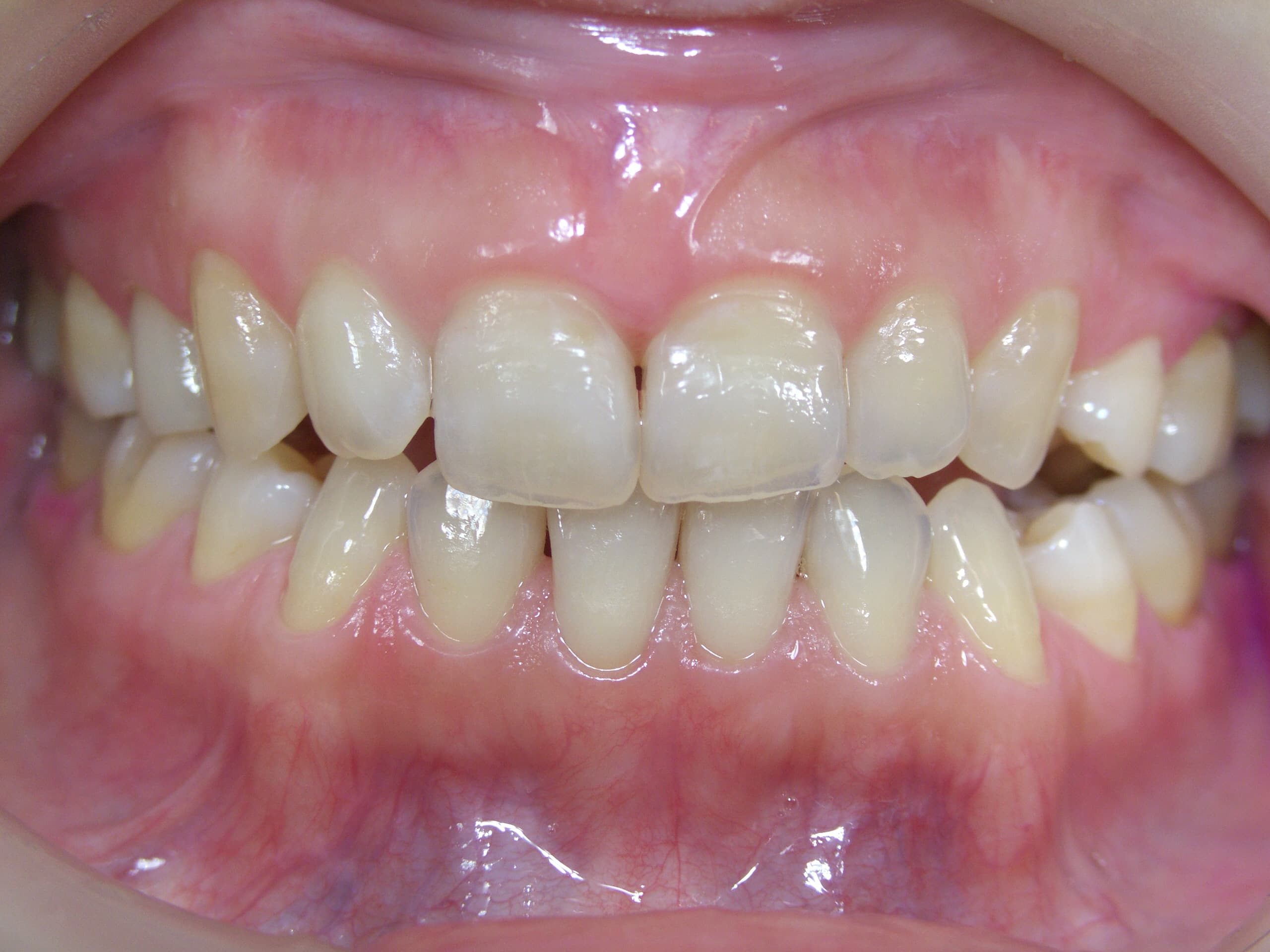 0000003213_%e5%ae%89%e9%83%a8-%e9%9d%99%e6%81%b5_camera_20141225180041