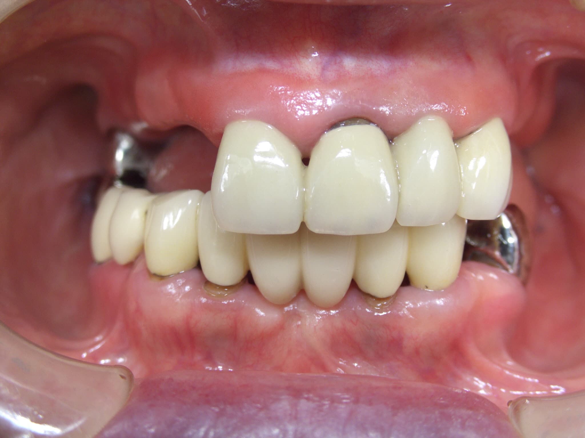 0000003272_%e5%8f%a4%e5%b1%8b-%e5%af%8c%e4%b9%85%e7%be%8e_camera_20141105225732