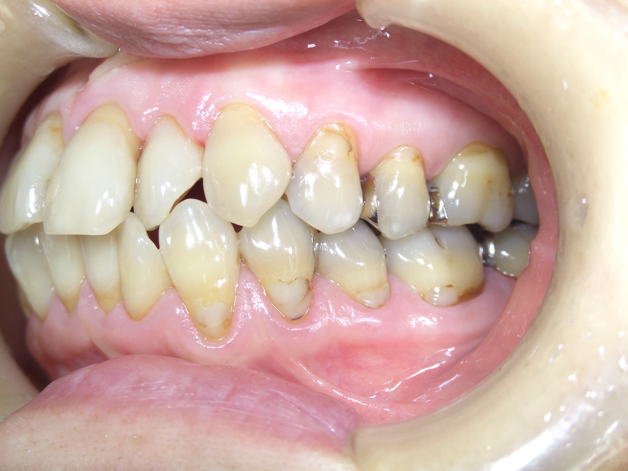 0000003276_%e6%9d%be%e7%94%b0-%e7%be%8e%e7%b4%80_camera_20150213154559