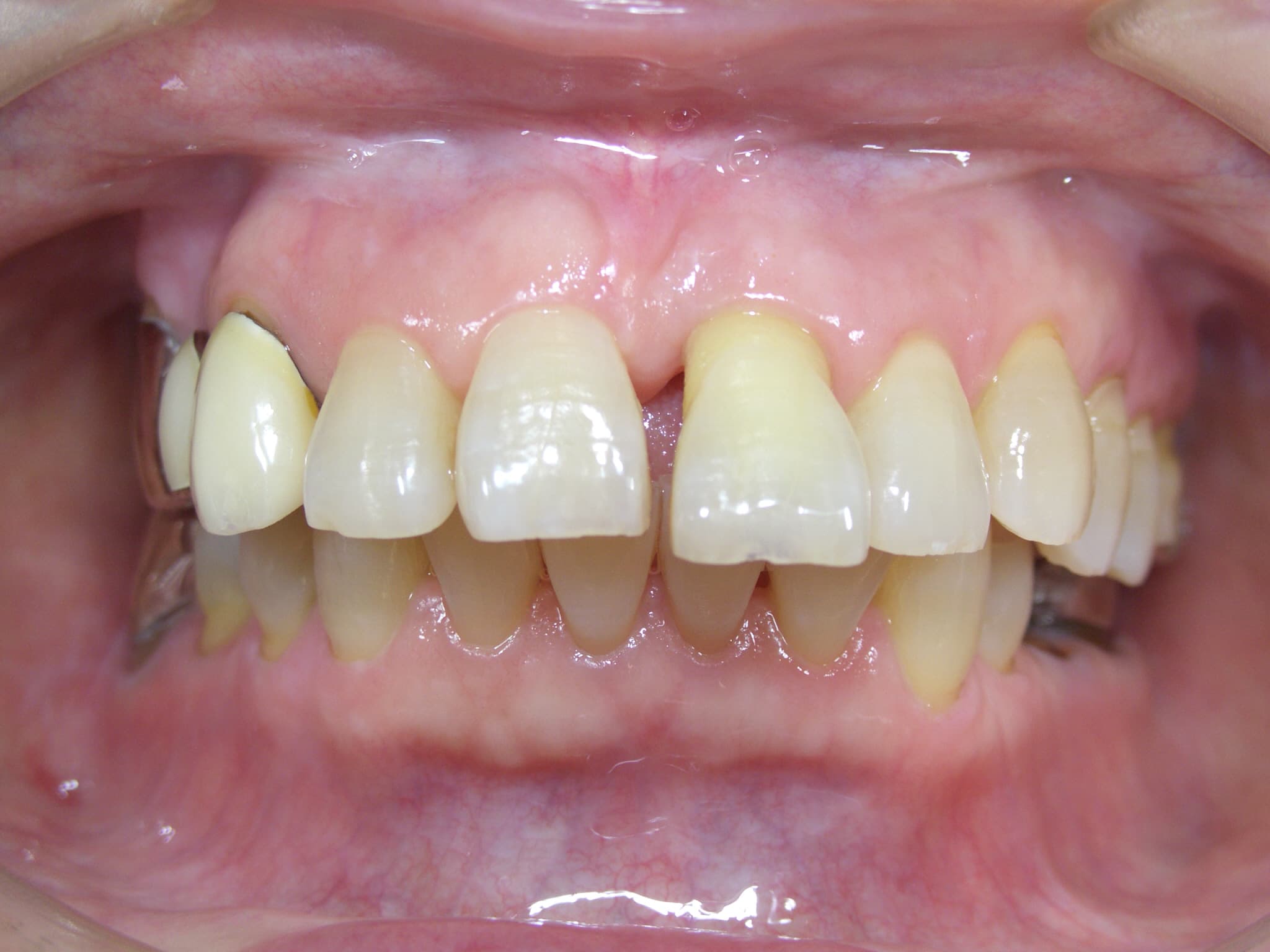 0000003342_%e4%bd%90%e8%97%a4-%e7%85%a7%e5%ad%90_camera_20150707145730