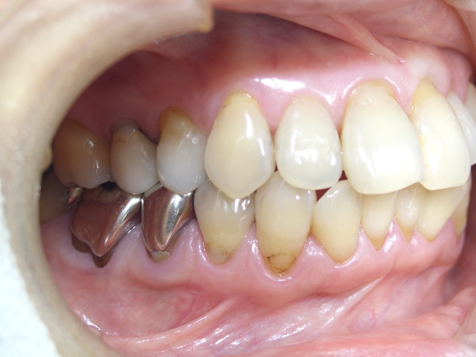 0000003276_%e6%9d%be%e7%94%b0-%e7%be%8e%e7%b4%80_camera_20140825011445