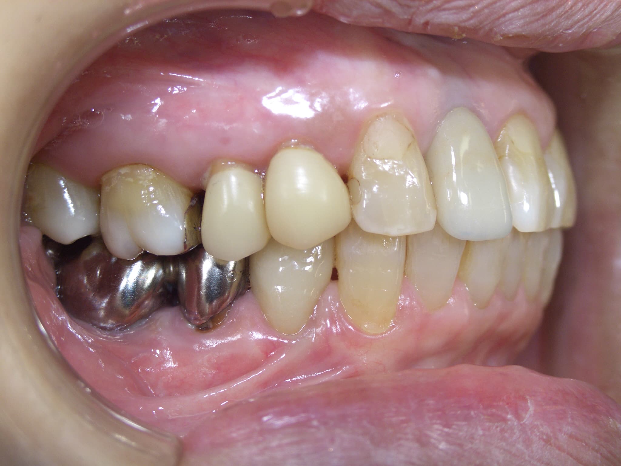 0000003309_%e5%b0%8f%e7%ac%a0%e5%8e%9f-%e7%ab%a0%e5%ad%90_camera_20050103005221