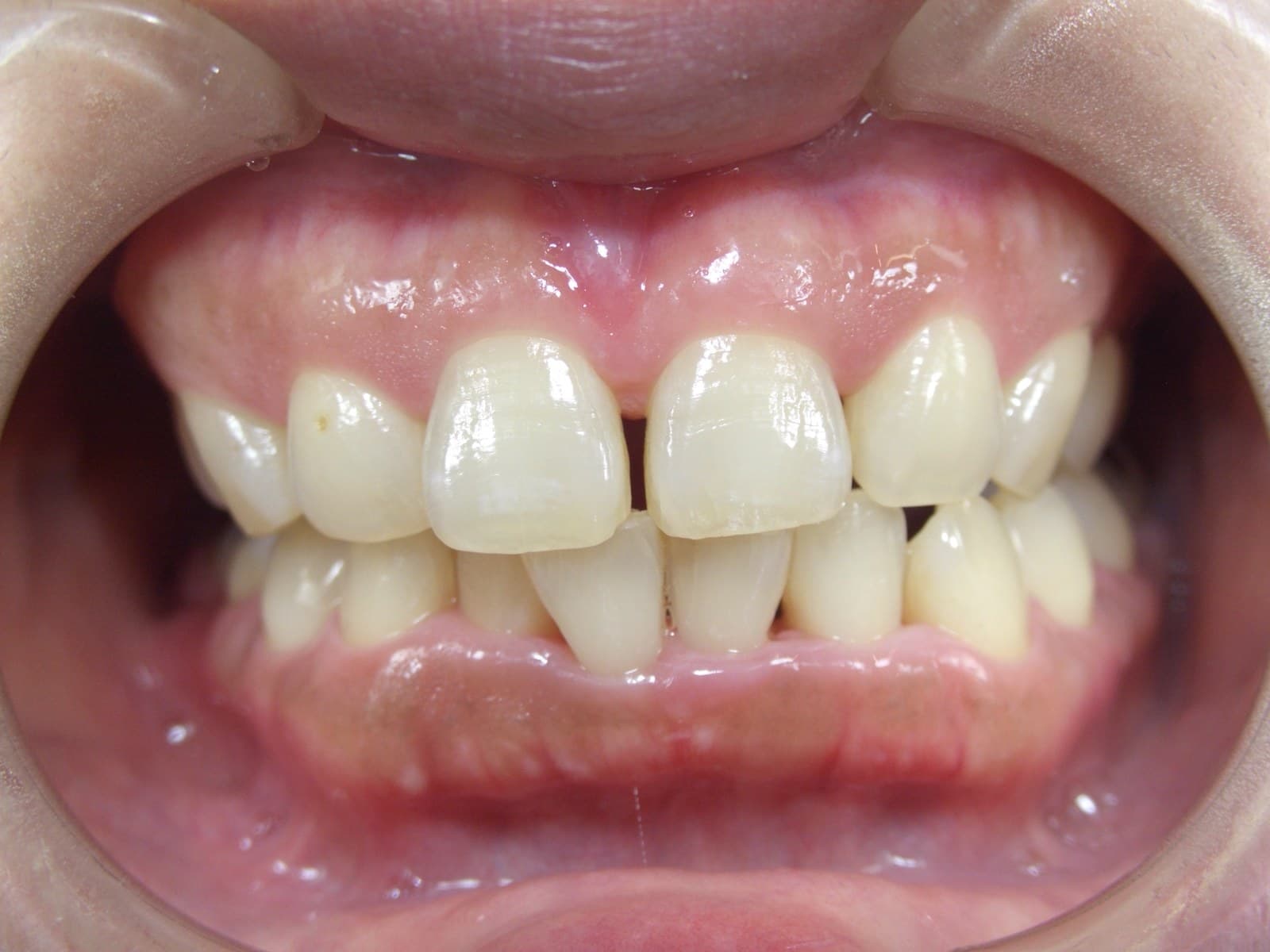 %e8%8f%85%e5%8e%9f-%e9%ba%bb%e9%87%8c%e5%ad%90_c01_20140601_204238012