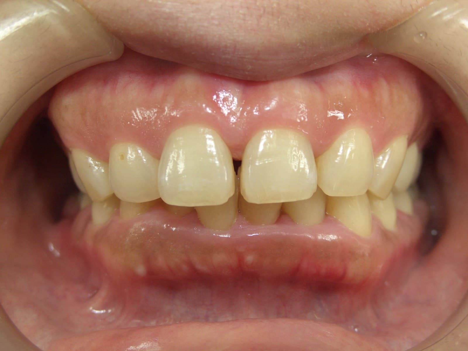 %e8%8f%85%e5%8e%9f-%e9%ba%bb%e9%87%8c%e5%ad%90_c01_20140127_123224003