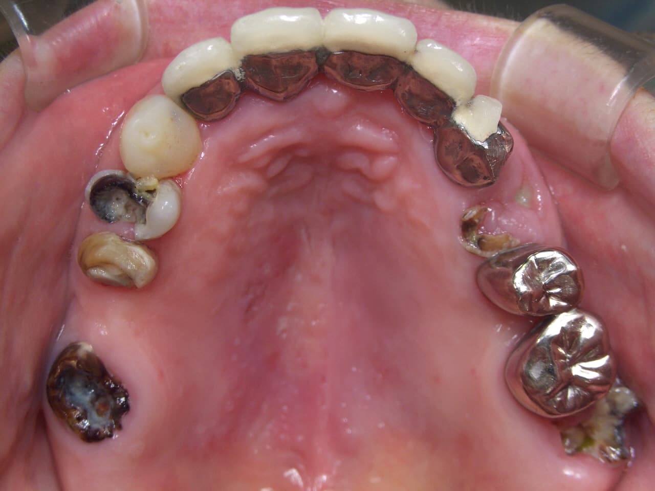 0000001770_%e4%bd%90%e8%97%a4-%e7%9c%9e%e6%9c%a8%e5%ad%90_camera_20100924153158