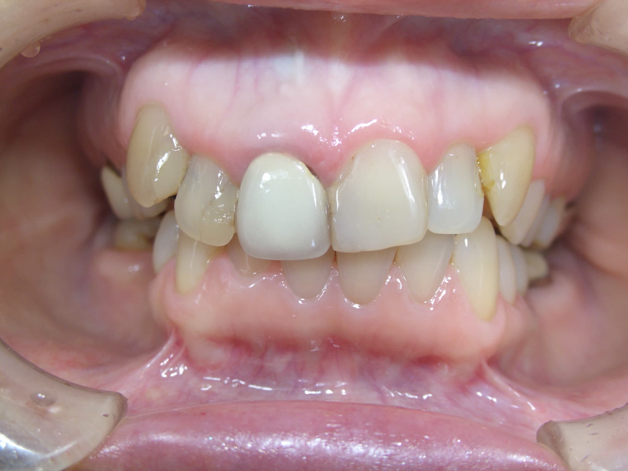 0000003411_%e5%b1%b1%e5%8f%a3-%e5%af%bf%e7%be%8e_camera_20150523100949