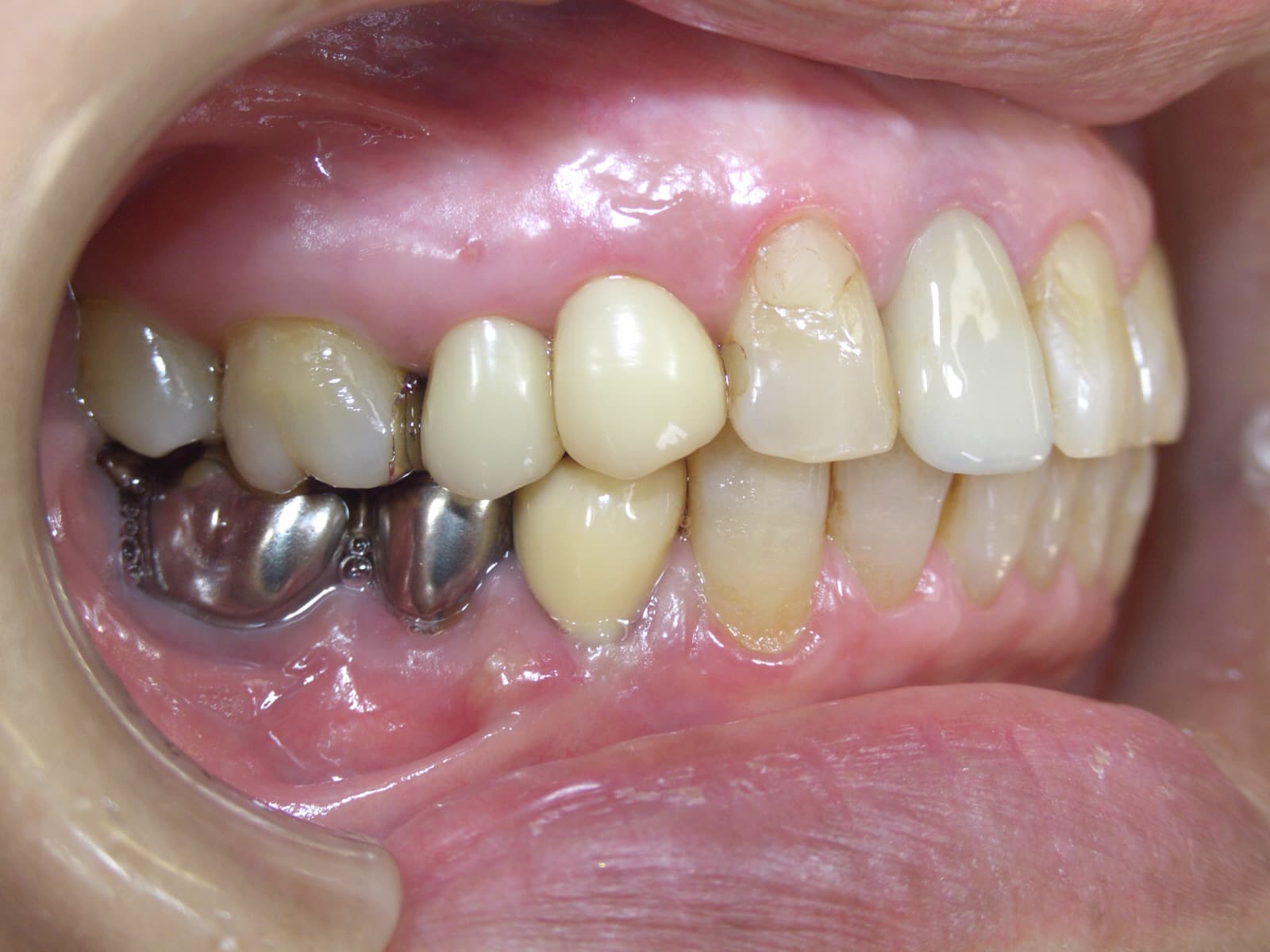 0000003309_%e5%b0%8f%e7%ac%a0%e5%8e%9f-%e7%ab%a0%e5%ad%90_camera_20141007152713