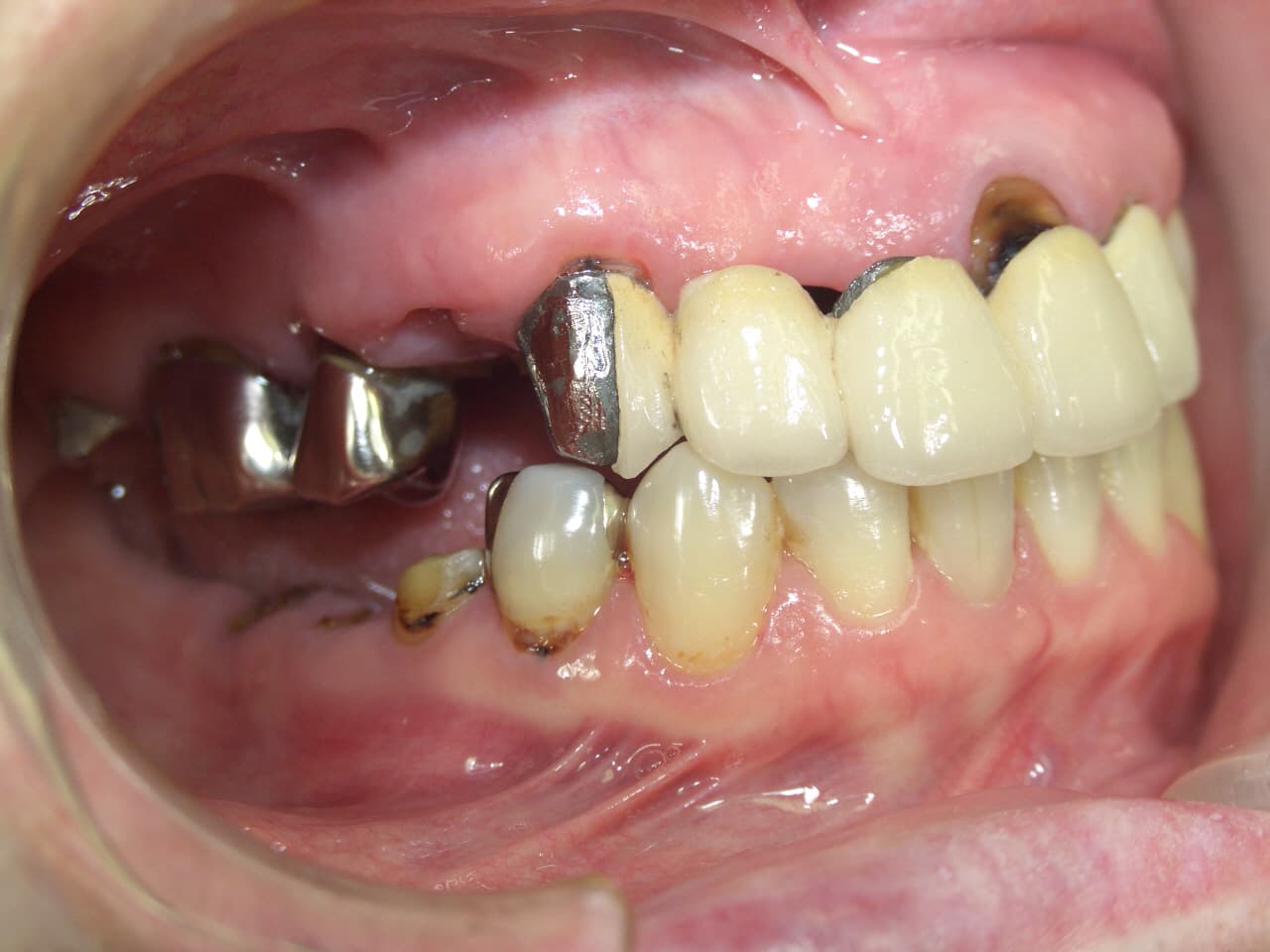 0000001770_%e4%bd%90%e8%97%a4-%e7%9c%9e%e6%9c%a8%e5%ad%90_camera_20100924152844