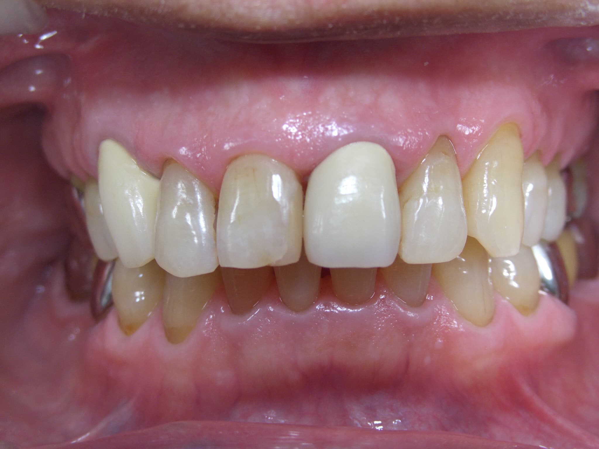 0000003255_%e9%b9%bf%e9%87%8e-%e6%86%b2%e6%b2%bb_camera_20141117033950