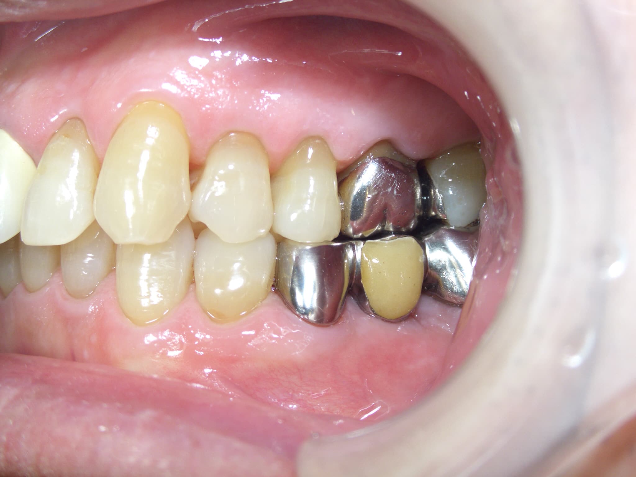 0000003255_%e9%b9%bf%e9%87%8e-%e6%86%b2%e6%b2%bb_camera_20141117034026