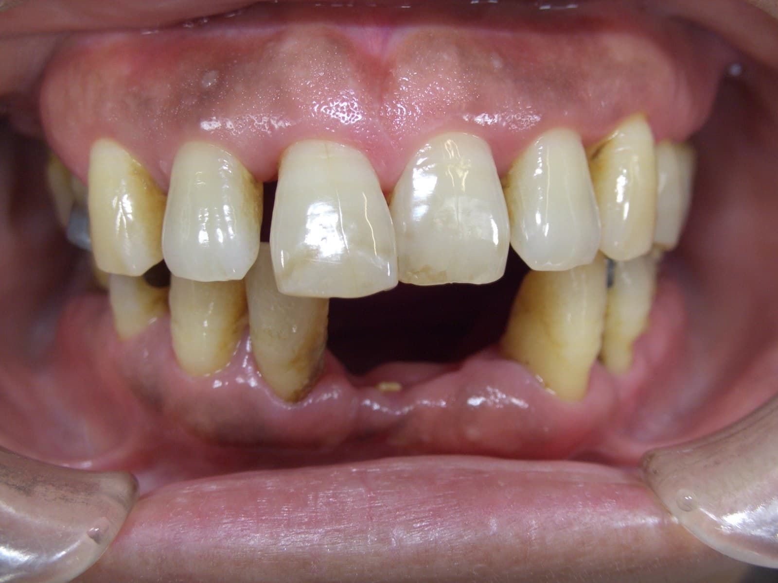 %e5%9c%9f%e7%94%b0-%e3%81%a4%e3%81%9f%e3%81%88_c01_20140718_140940007