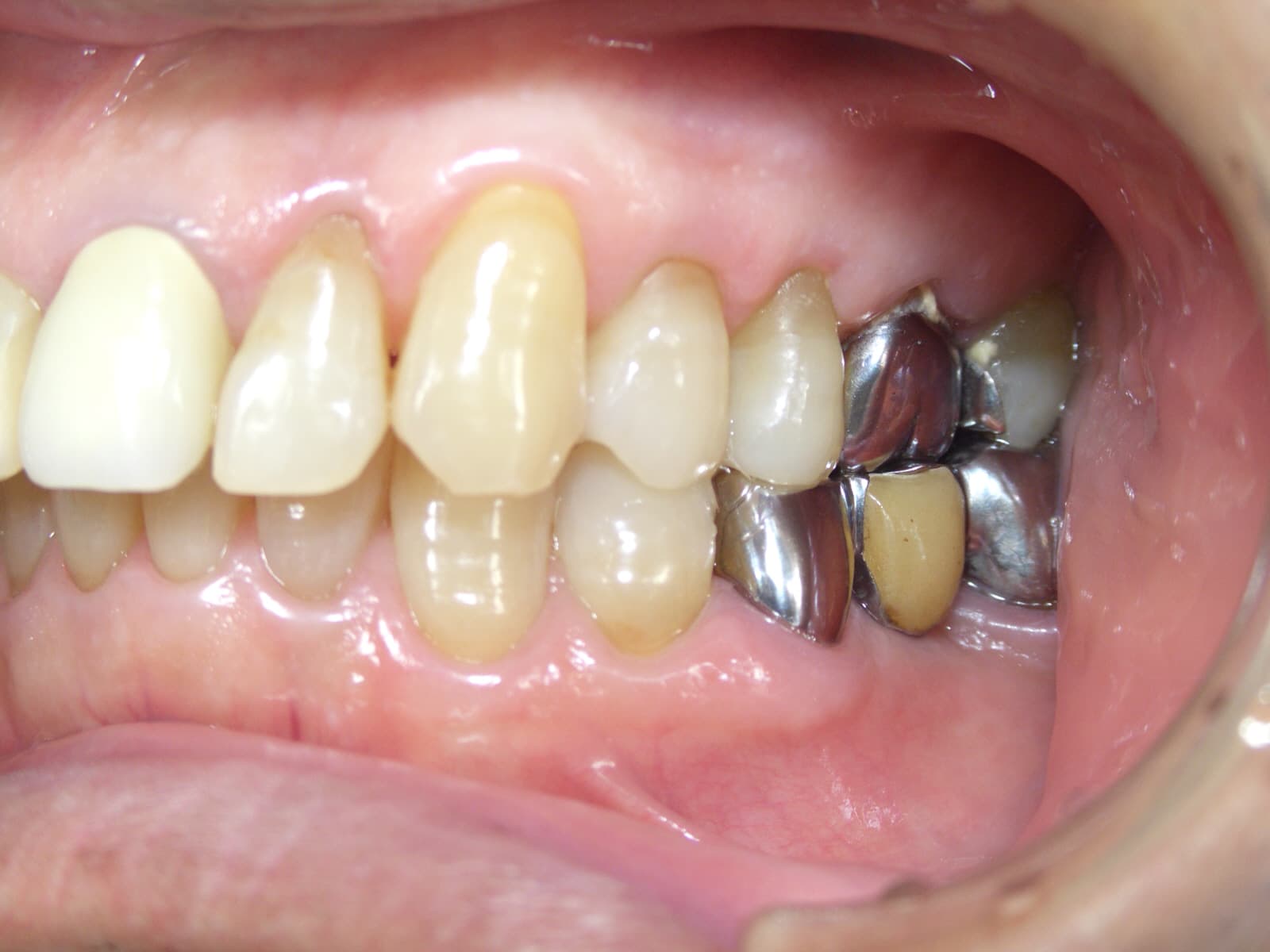 0000003255_%e9%b9%bf%e9%87%8e-%e6%86%b2%e6%b2%bb_camera_20140805111308