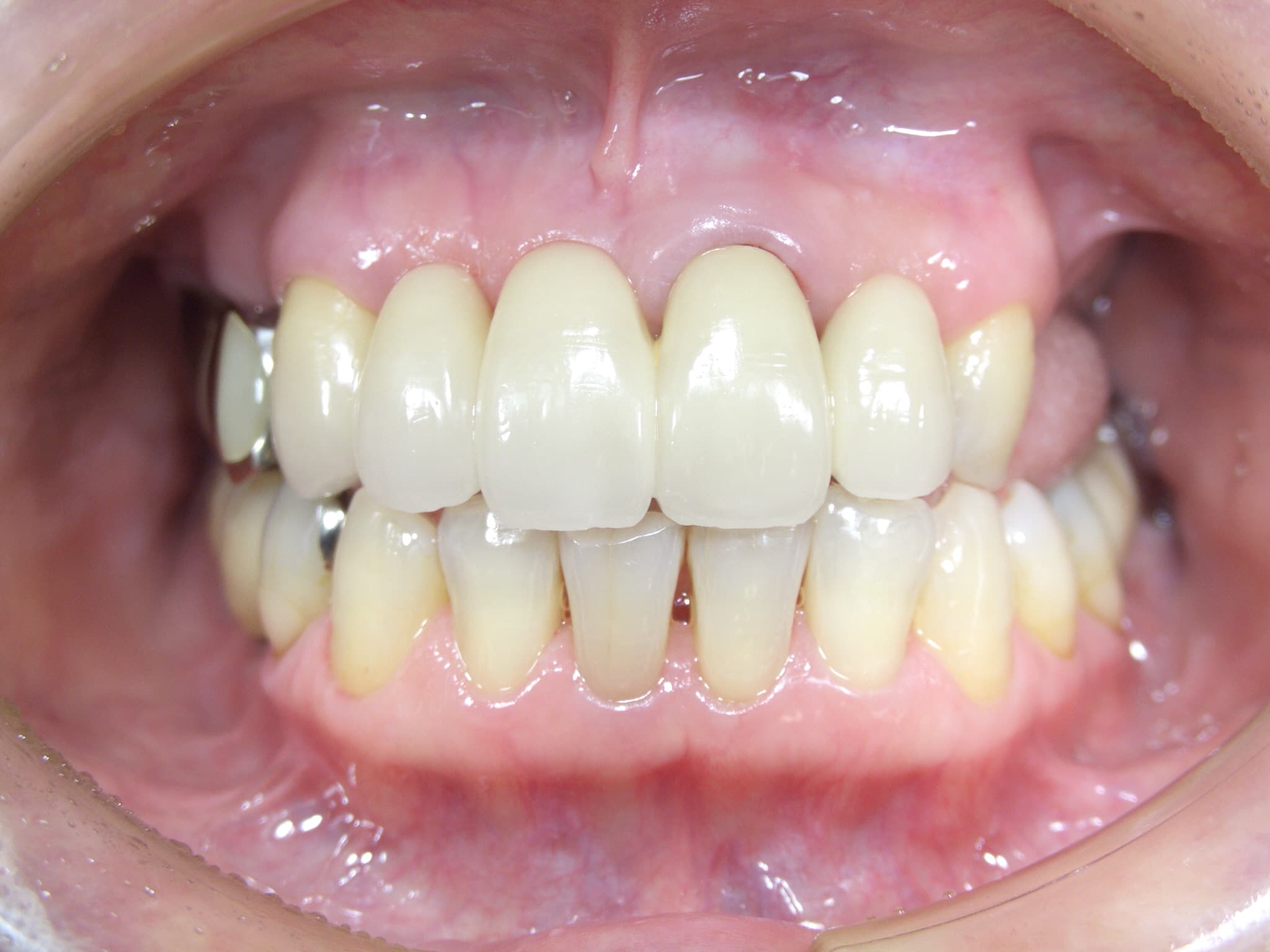 0000001770_%e4%bd%90%e8%97%a4-%e7%9c%9e%e6%9c%a8%e5%ad%90_camera_20160204144920