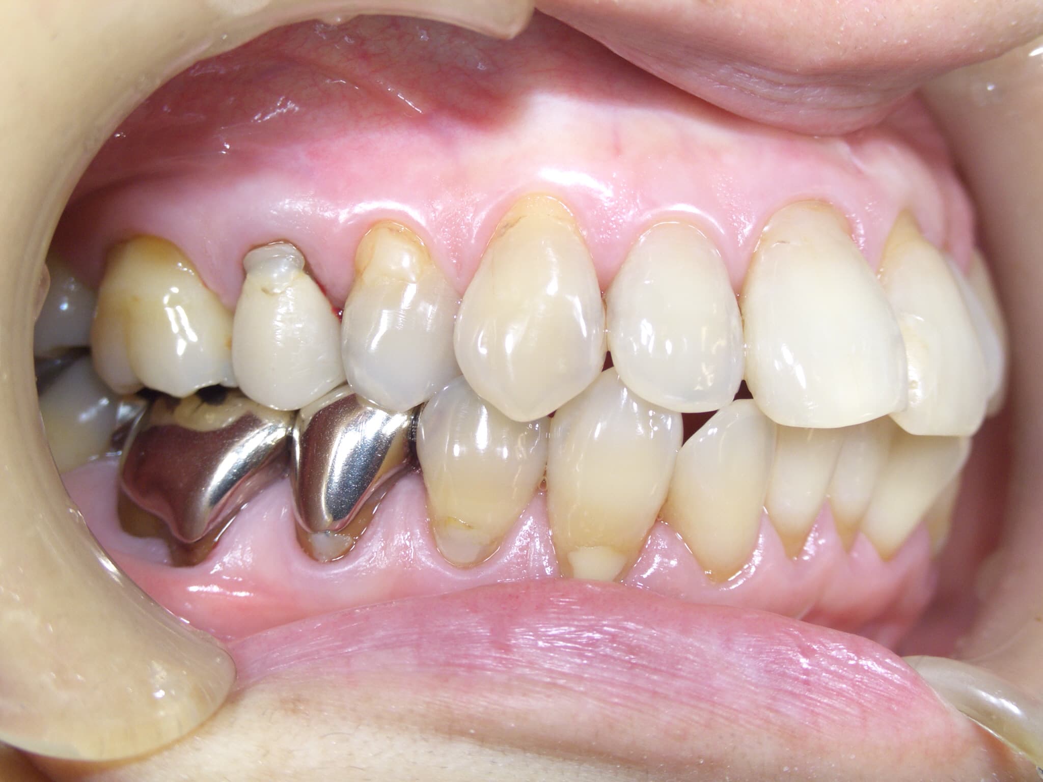 0000003276_%e6%9d%be%e7%94%b0-%e7%be%8e%e7%b4%80_camera_20150213154545