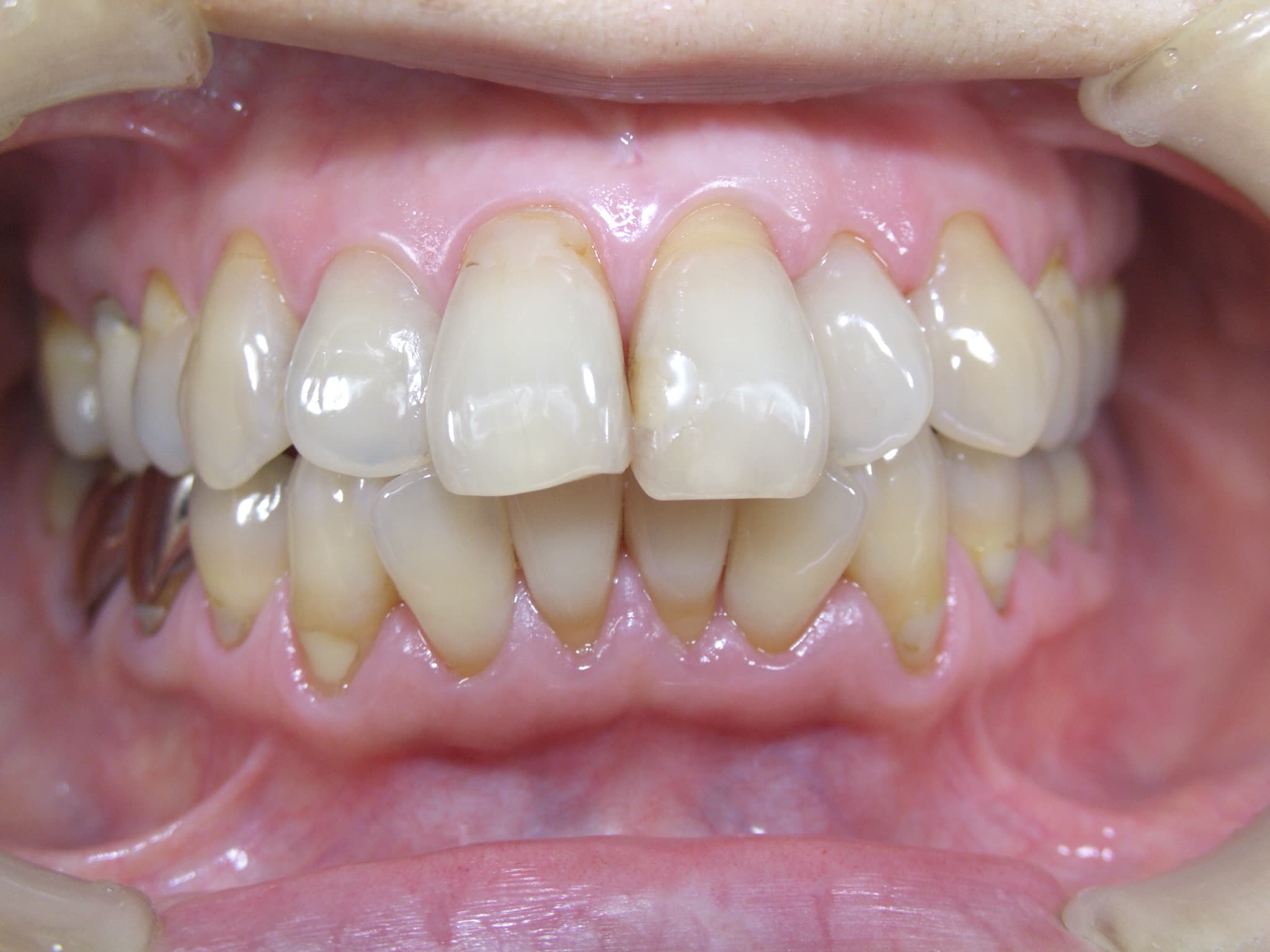 0000003276_%e6%9d%be%e7%94%b0-%e7%be%8e%e7%b4%80_camera_20150213154528