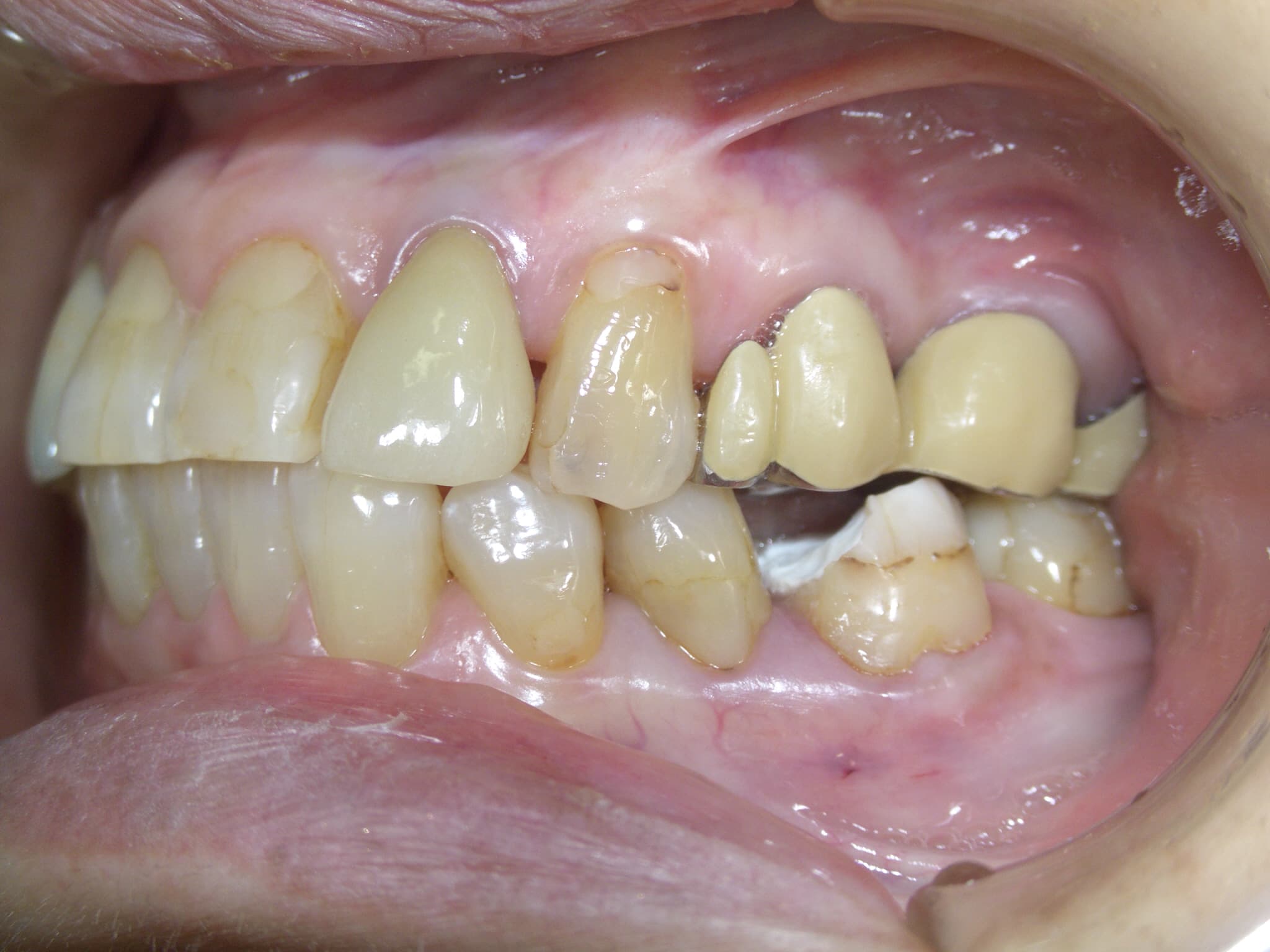 0000003309_%e5%b0%8f%e7%ac%a0%e5%8e%9f-%e7%ab%a0%e5%ad%90_camera_20050103005239