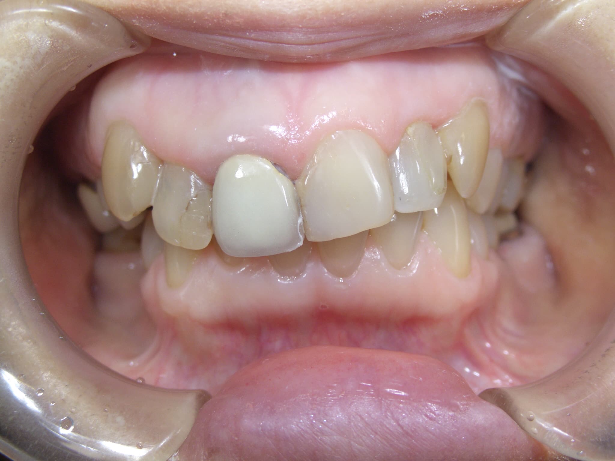 0000003411_%e5%b1%b1%e5%8f%a3-%e5%af%bf%e7%be%8e_camera_20151030221754