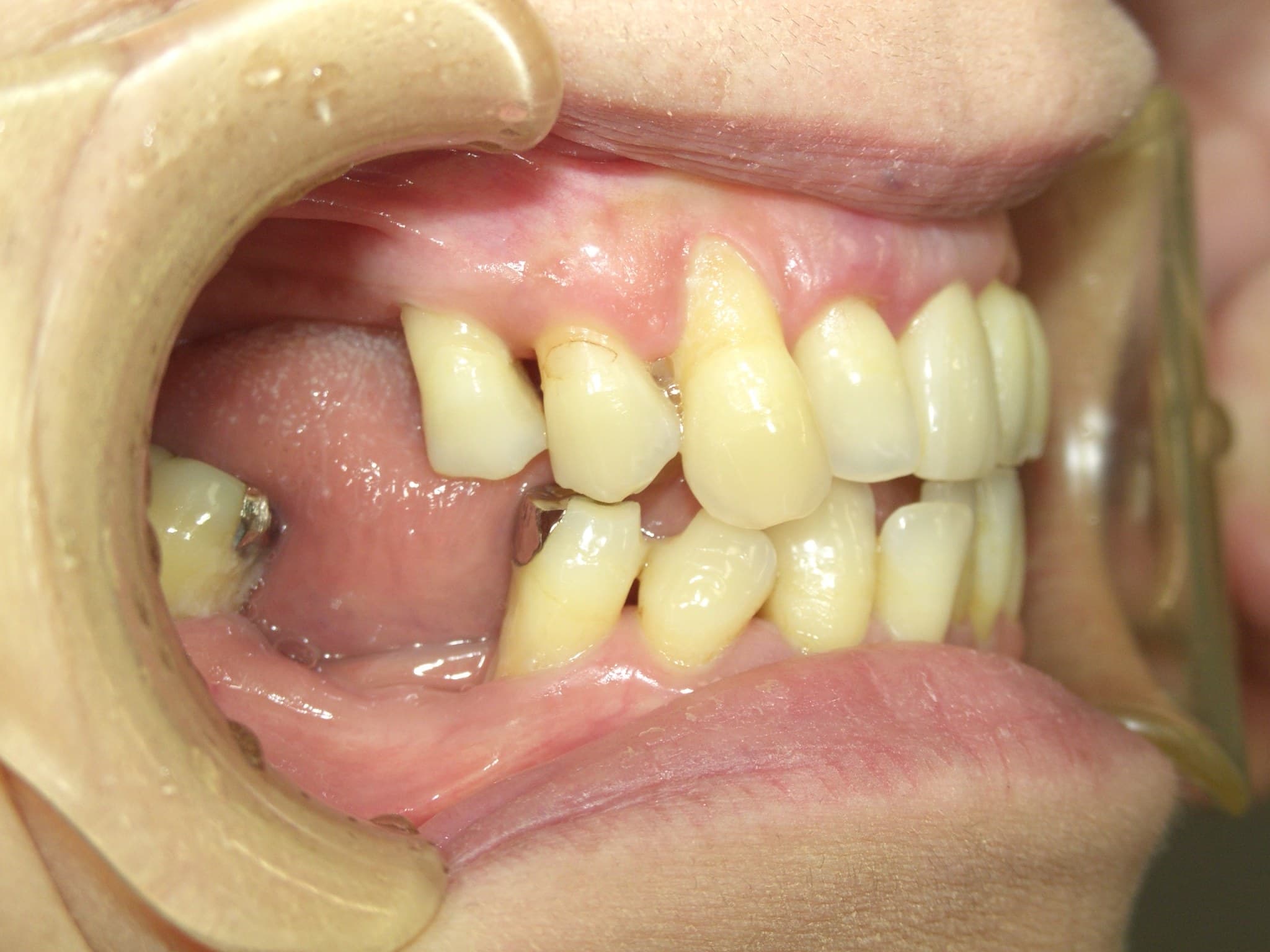 %e4%b8%ad%e8%a5%bf-%e6%b4%8b%e5%ad%90_c04_20150609_154844004