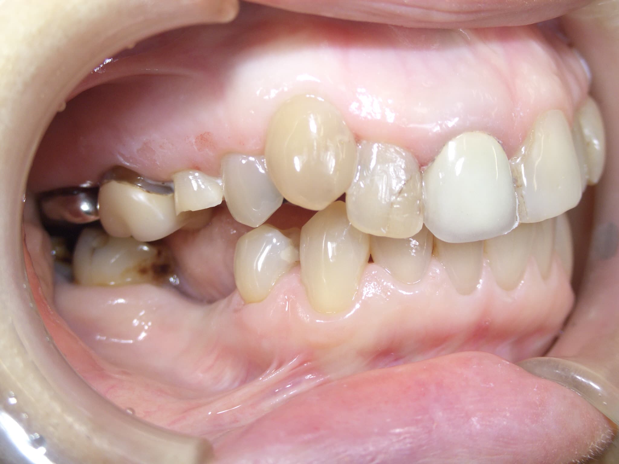 0000003411_%e5%b1%b1%e5%8f%a3-%e5%af%bf%e7%be%8e_camera_20151030221823