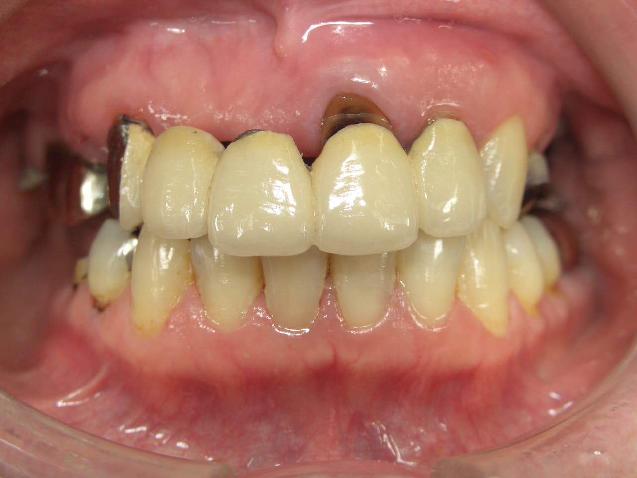 0000001770_%e4%bd%90%e8%97%a4-%e7%9c%9e%e6%9c%a8%e5%ad%90_camera_20100924152807