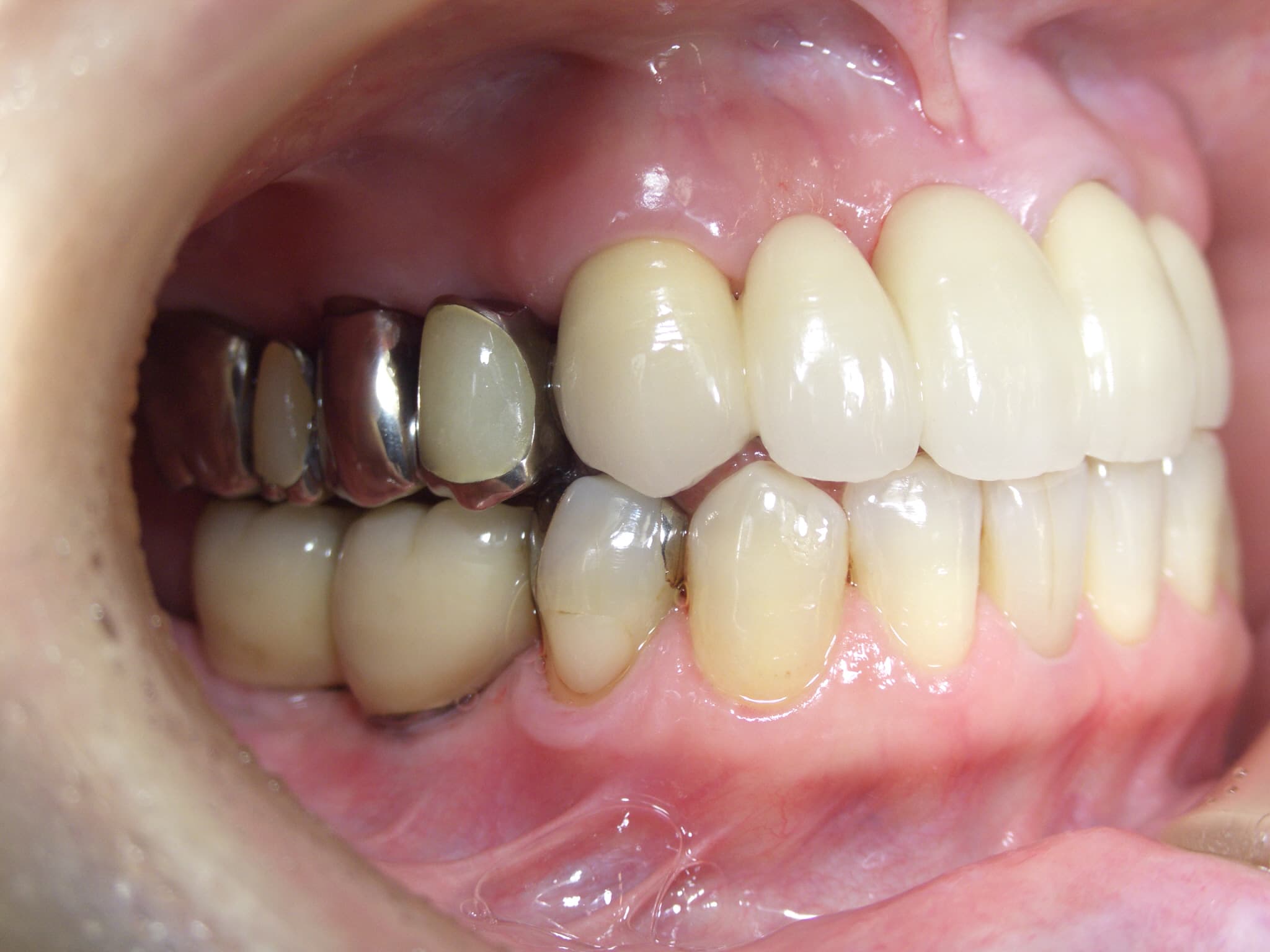 0000001770_%e4%bd%90%e8%97%a4-%e7%9c%9e%e6%9c%a8%e5%ad%90_camera_20160204144945