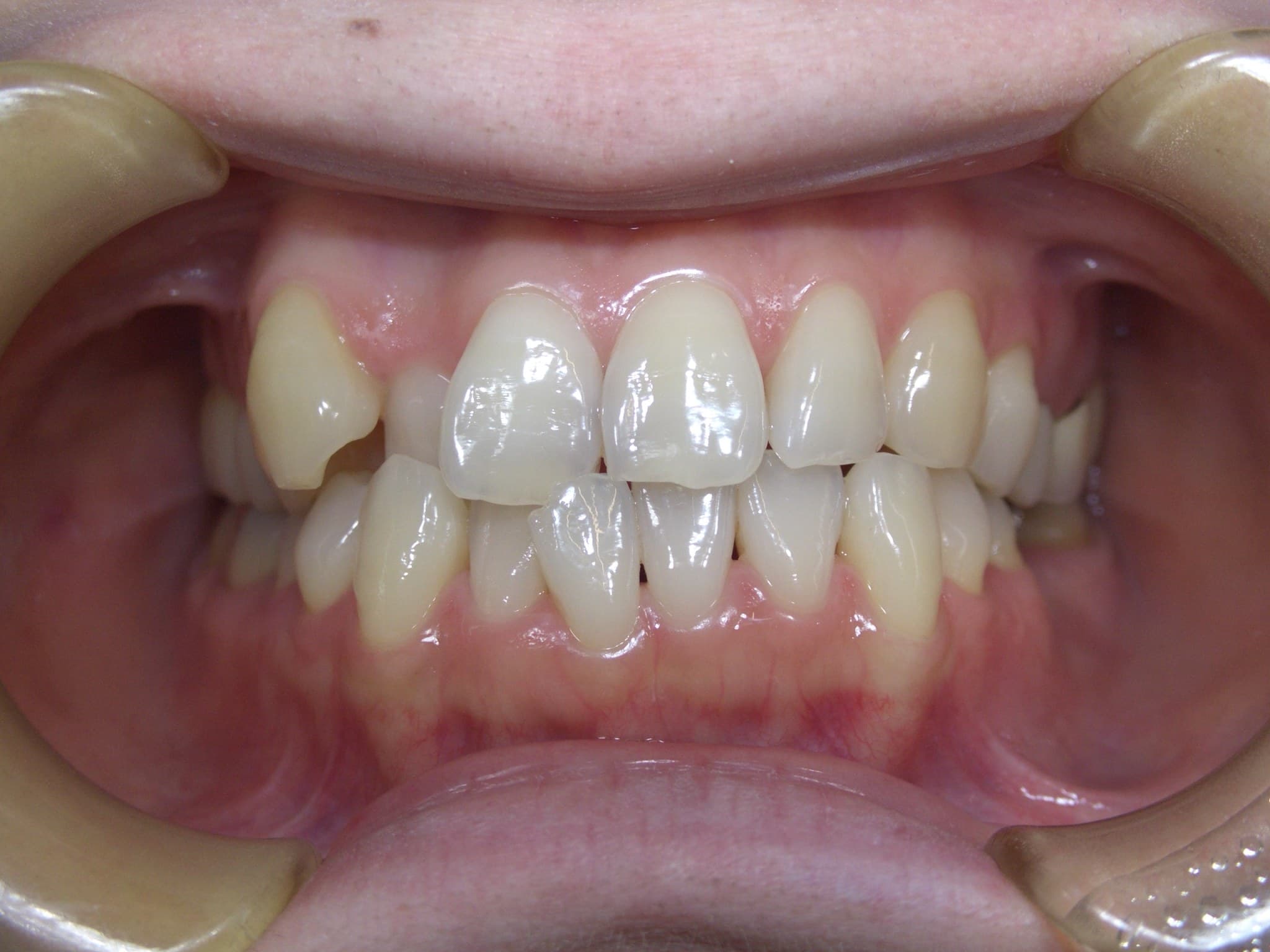 %e9%bd%8a%e8%97%a4-%e7%94%b1%e5%88%a9%e5%ad%90_c02_20160105_161854013