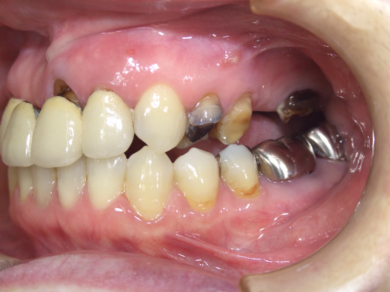 0000001770_%e4%bd%90%e8%97%a4-%e7%9c%9e%e6%9c%a8%e5%ad%90_camera_20100924152936